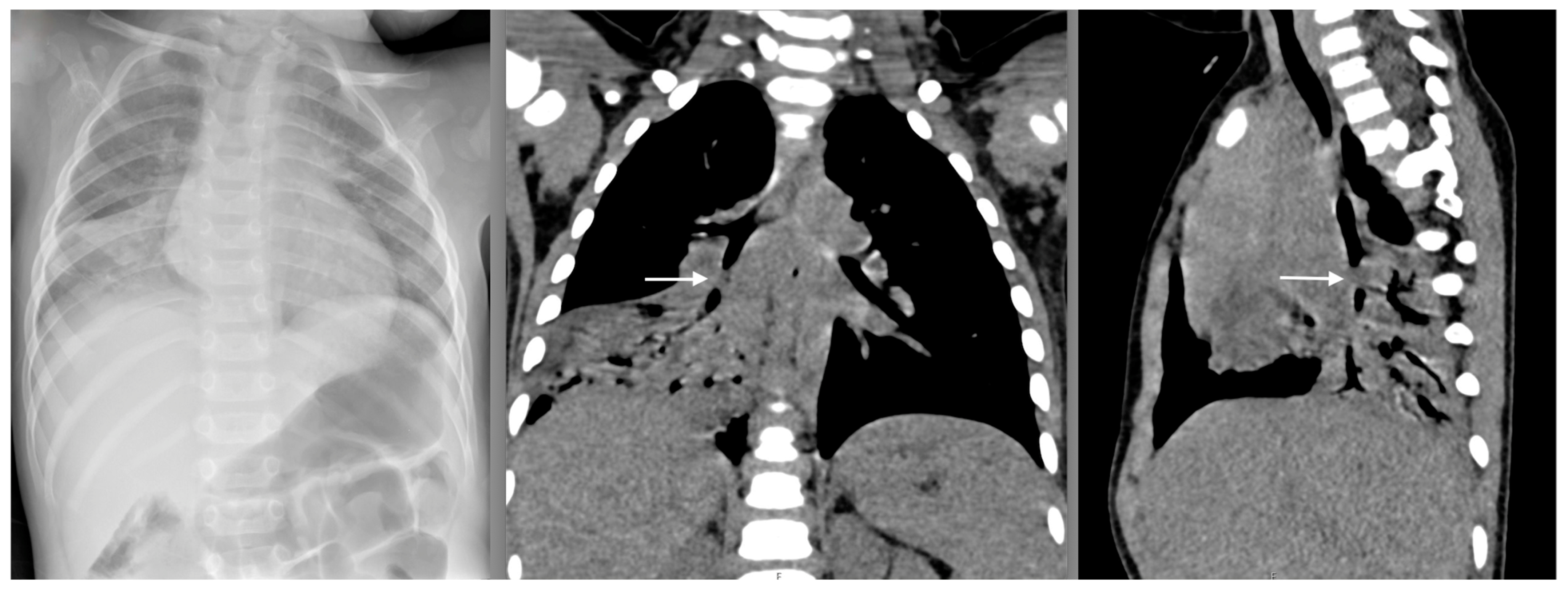 Pediatrrep 16 00042 g004 Pediatrrep 16 00042 g004