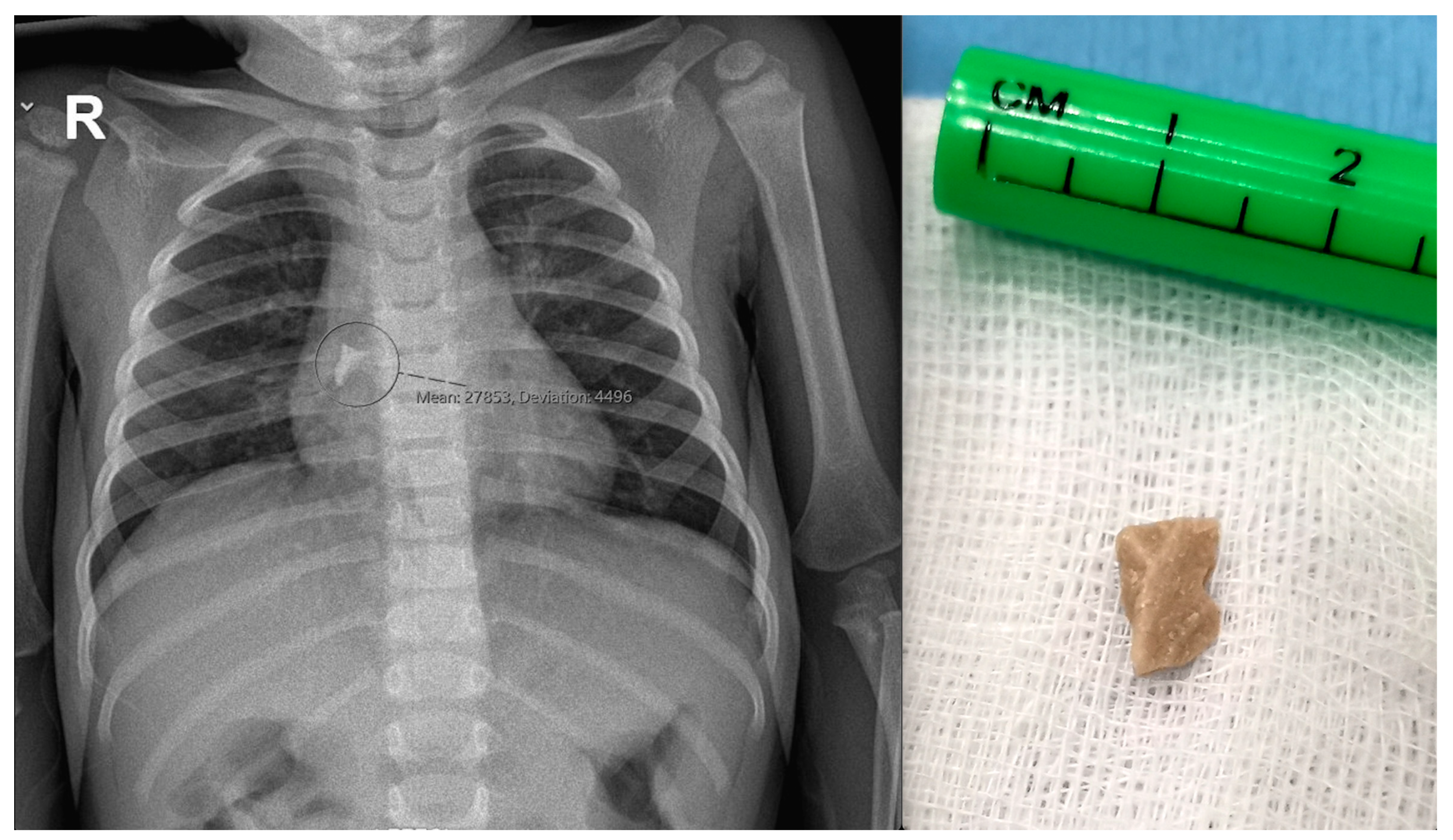 Pediatrrep 16 00042 g005 Pediatrrep 16 00042 g005