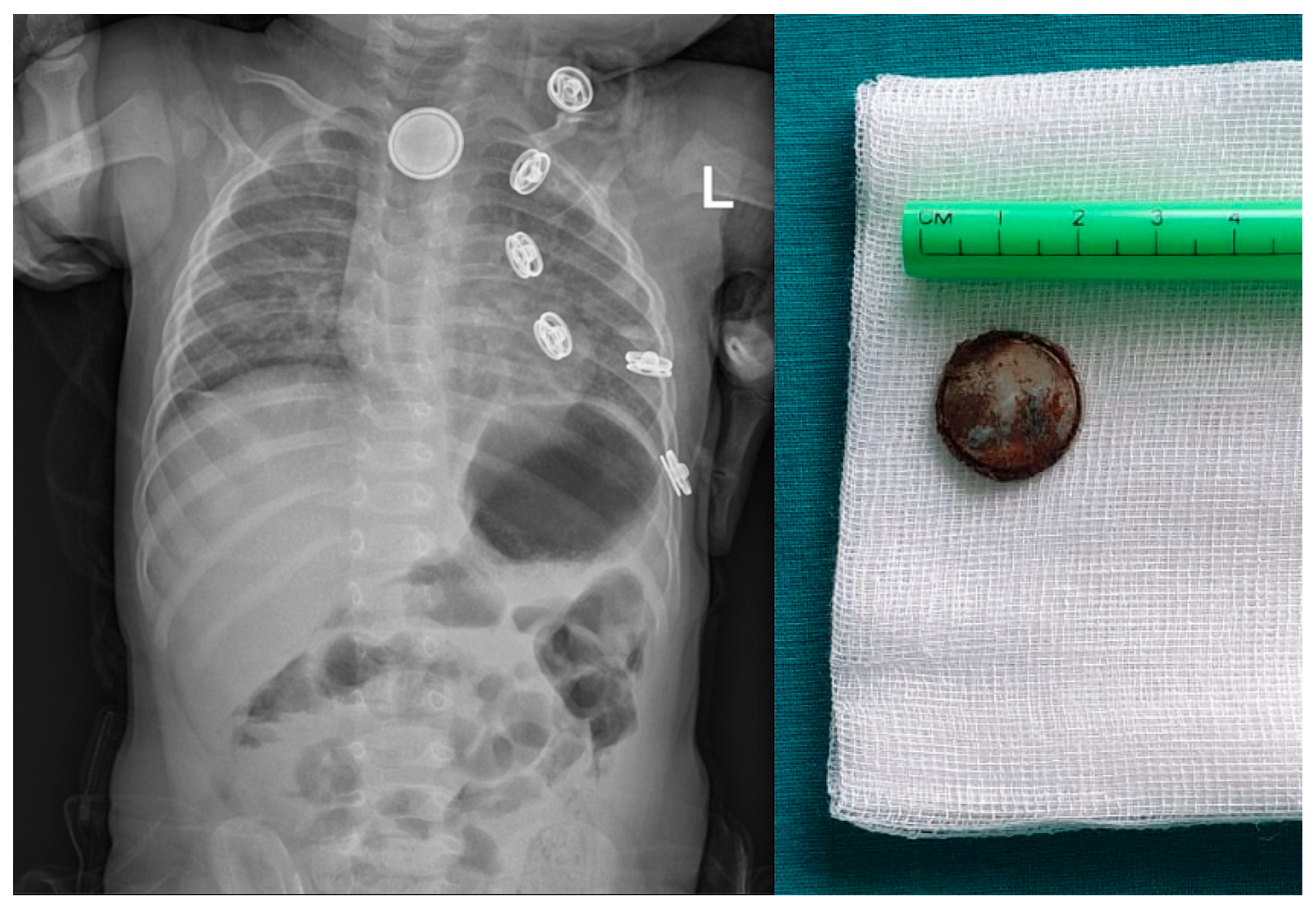 Pediatrrep 16 00042 g006 Pediatrrep 16 00042 g006