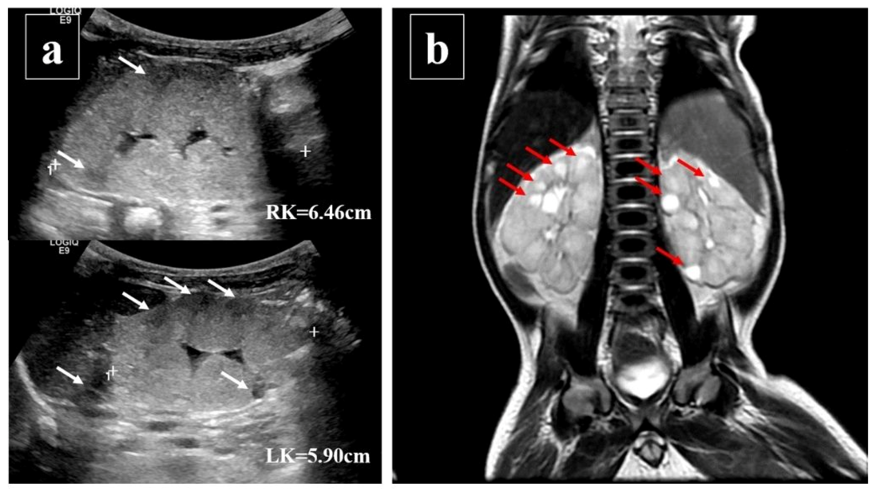Pediatrrep 17 00100 g001 Pediatrrep 17 00100 g001