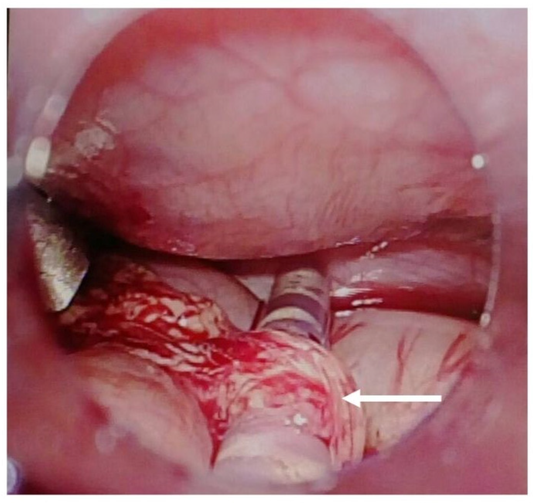 Pediatrrep 17 00100 g003 Pediatrrep 17 00100 g003