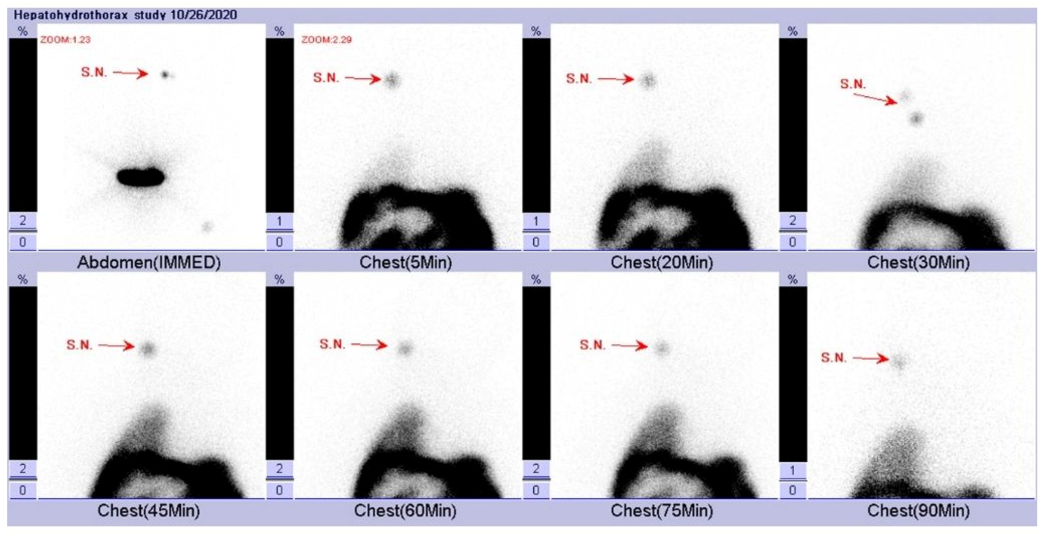 Pediatrrep 17 00100 g005 Pediatrrep 17 00100 g005