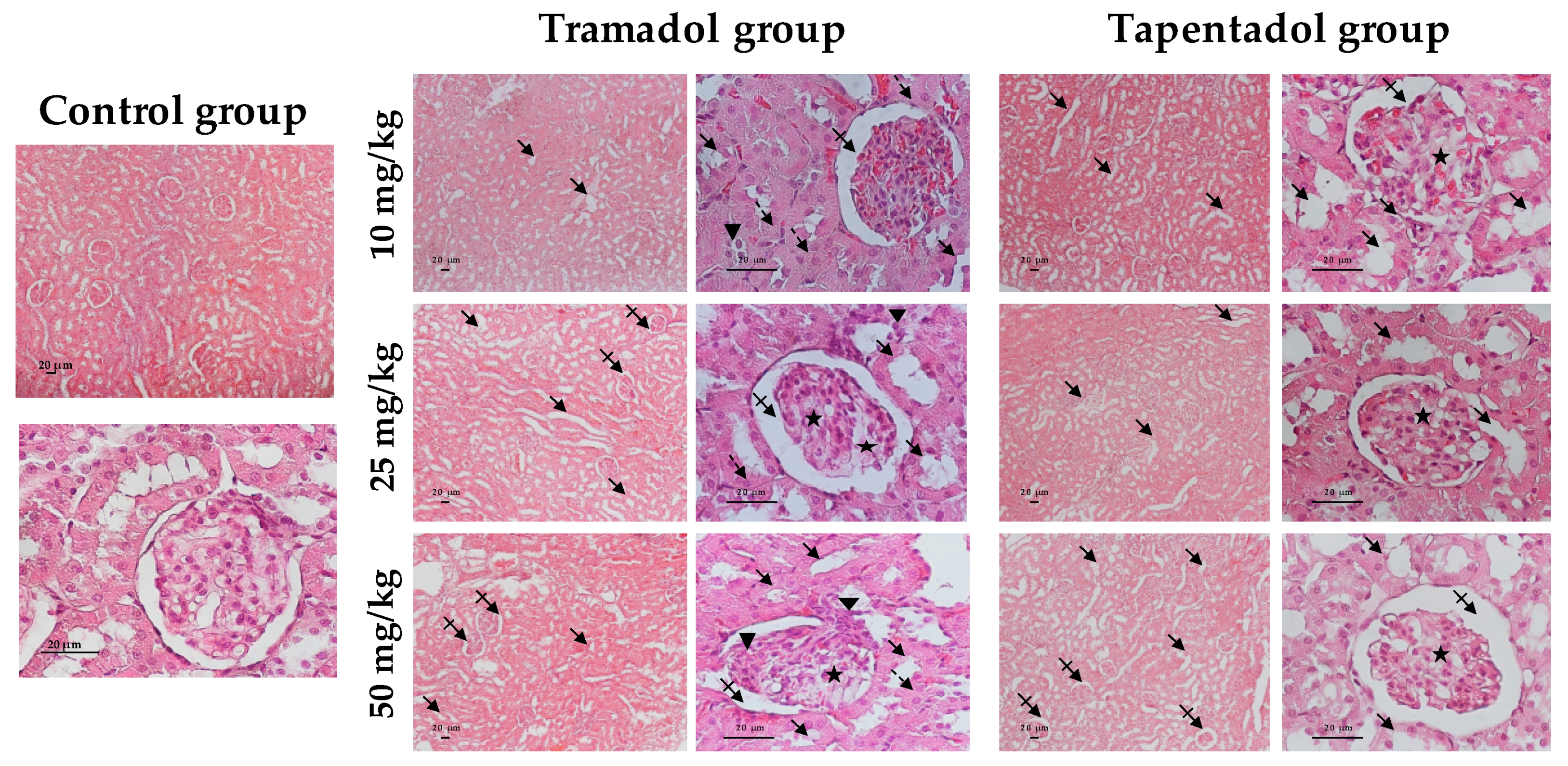 Pharmaceuticals Free Full Text Repeated Administration Of Clinical Doses Of Tramadol And Tapentadol Causes Hepato And Nephrotoxic Effects In Wistar Rats Html