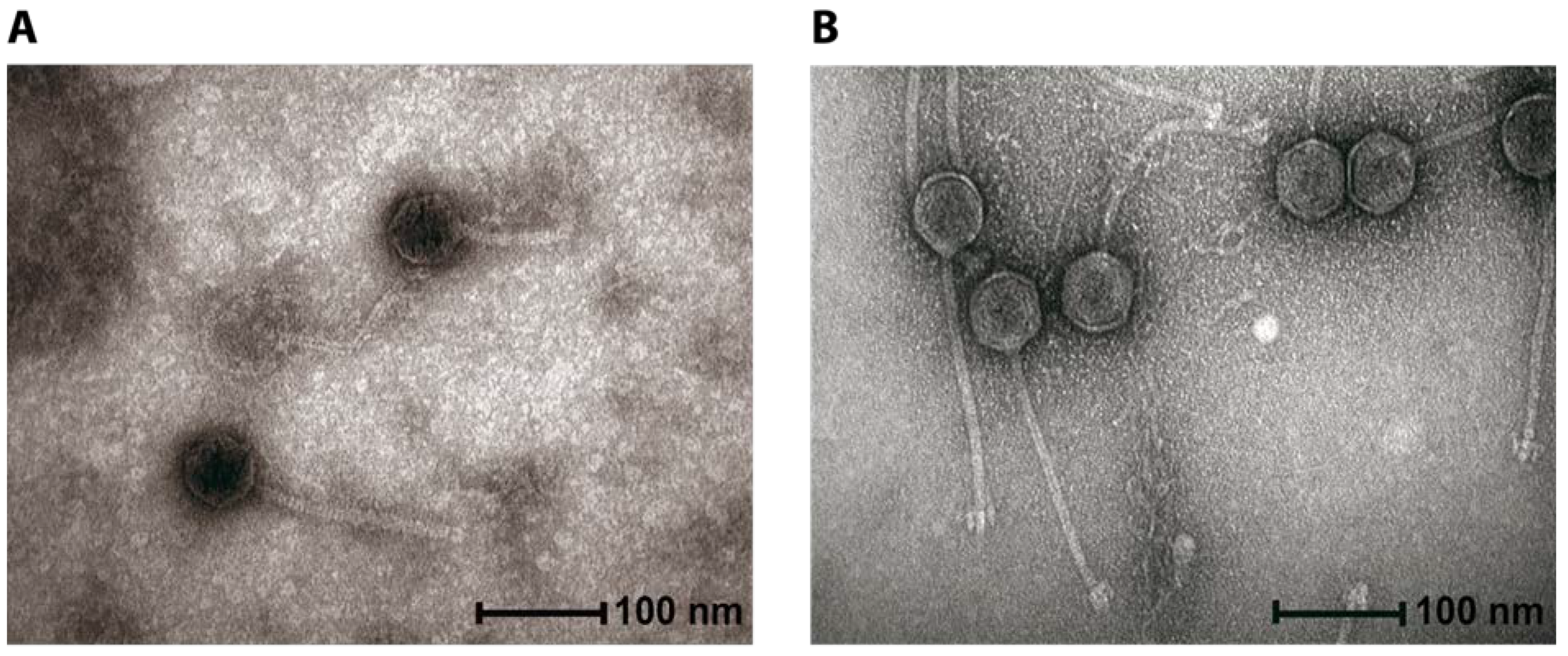 streptococcus pneumoniae electron micrograph