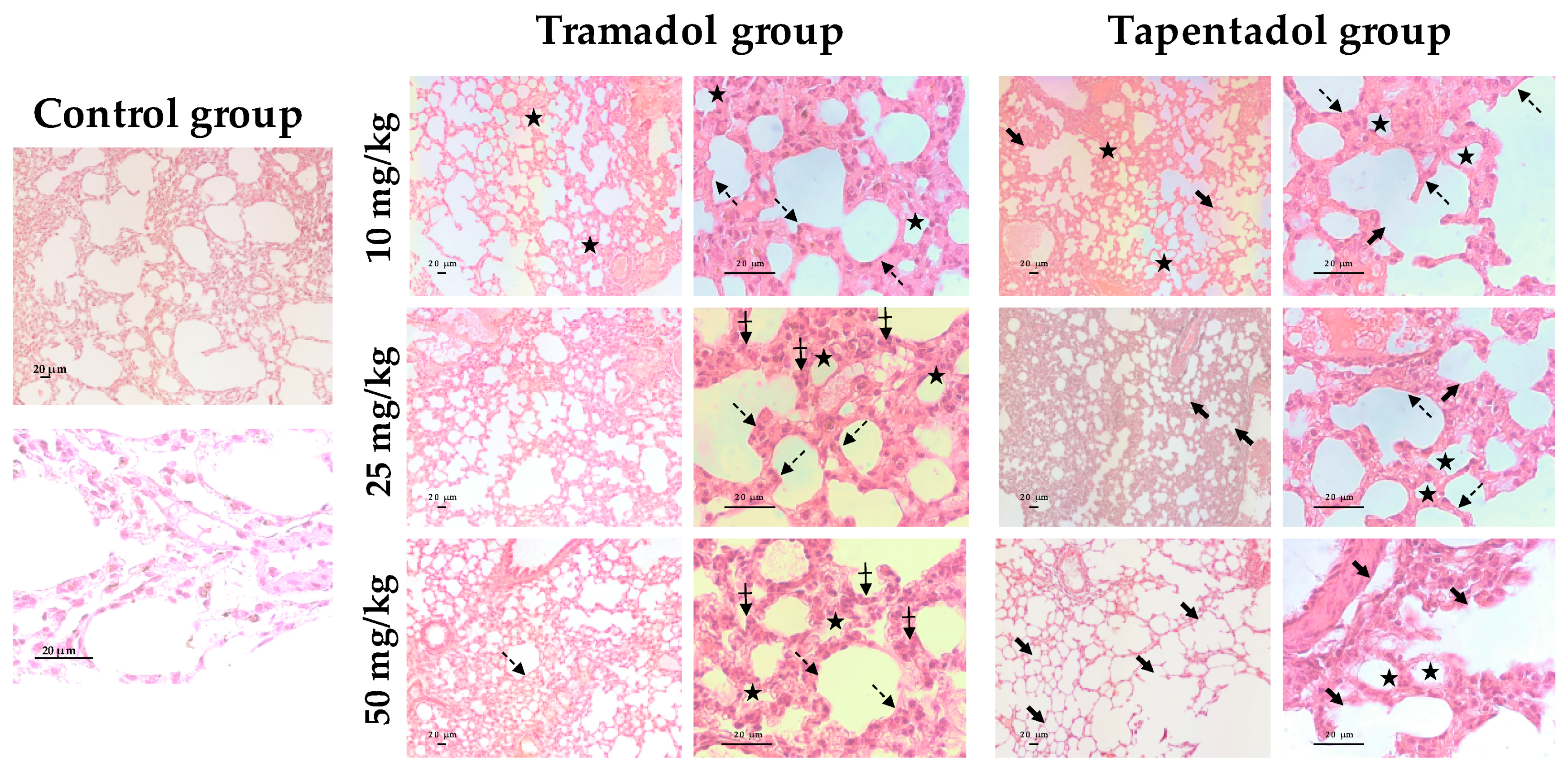 Pharmaceuticals Free Full Text Repeated Administration Of Clinically Relevant Doses Of The Prescription Opioids Tramadol And Tapentadol Causes Lung Cardiac And Brain Toxicity In Wistar Rats Html