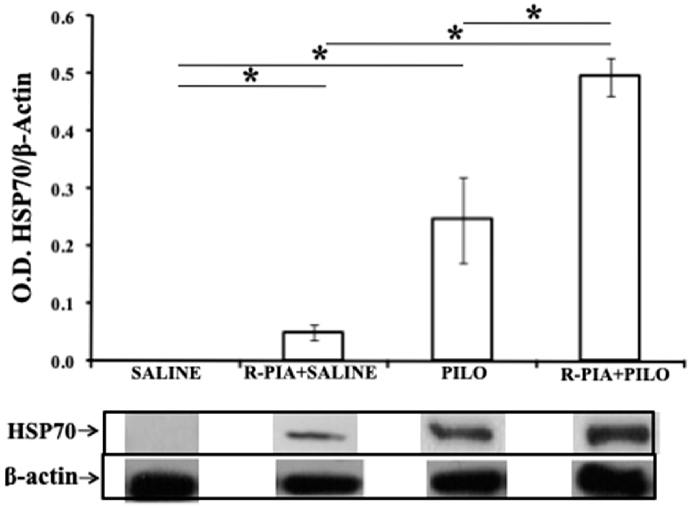 Pharmaceuticals 14 00376 g004 Pharmaceuticals 14 00376 g004