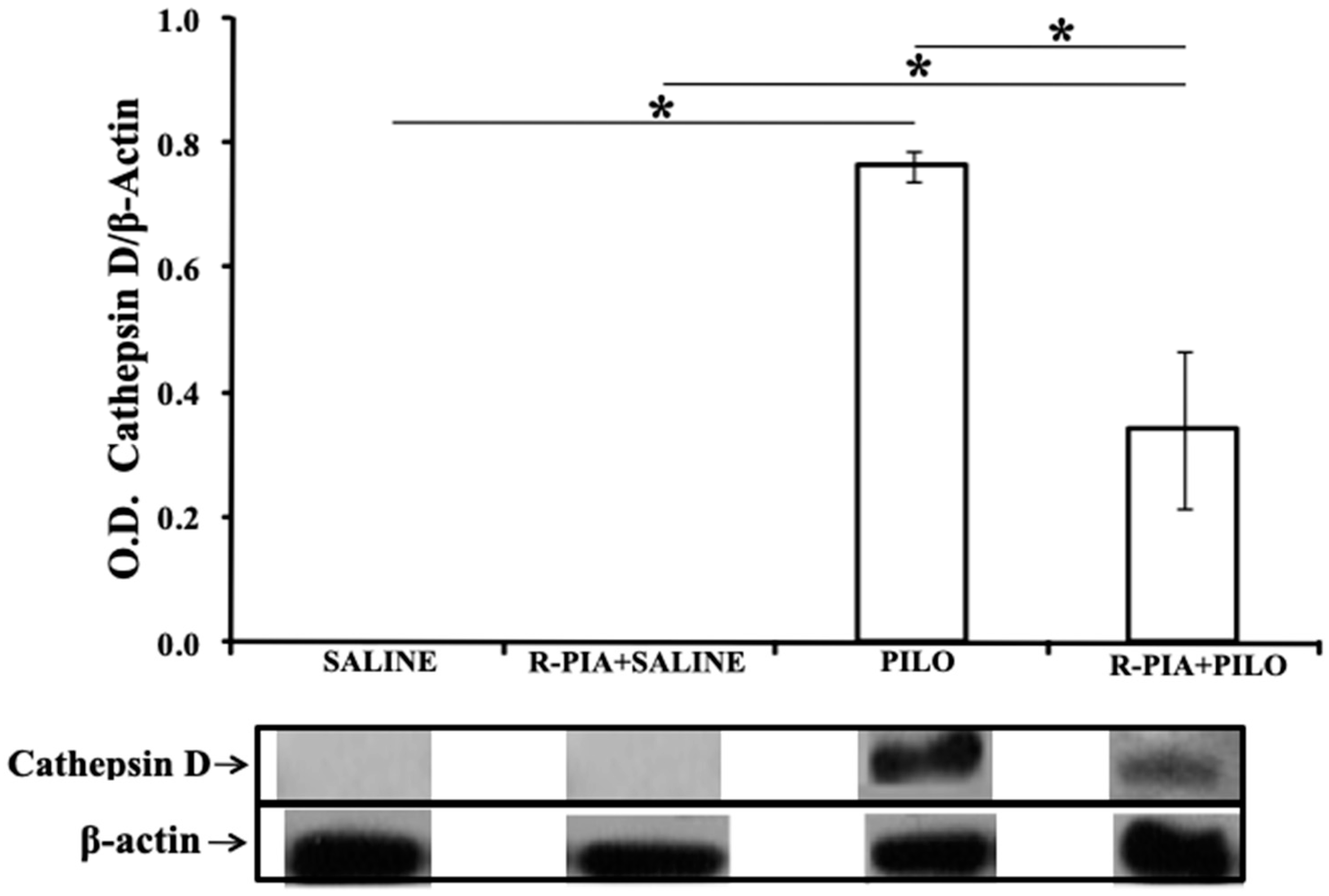 Pharmaceuticals 14 00376 g005 Pharmaceuticals 14 00376 g005