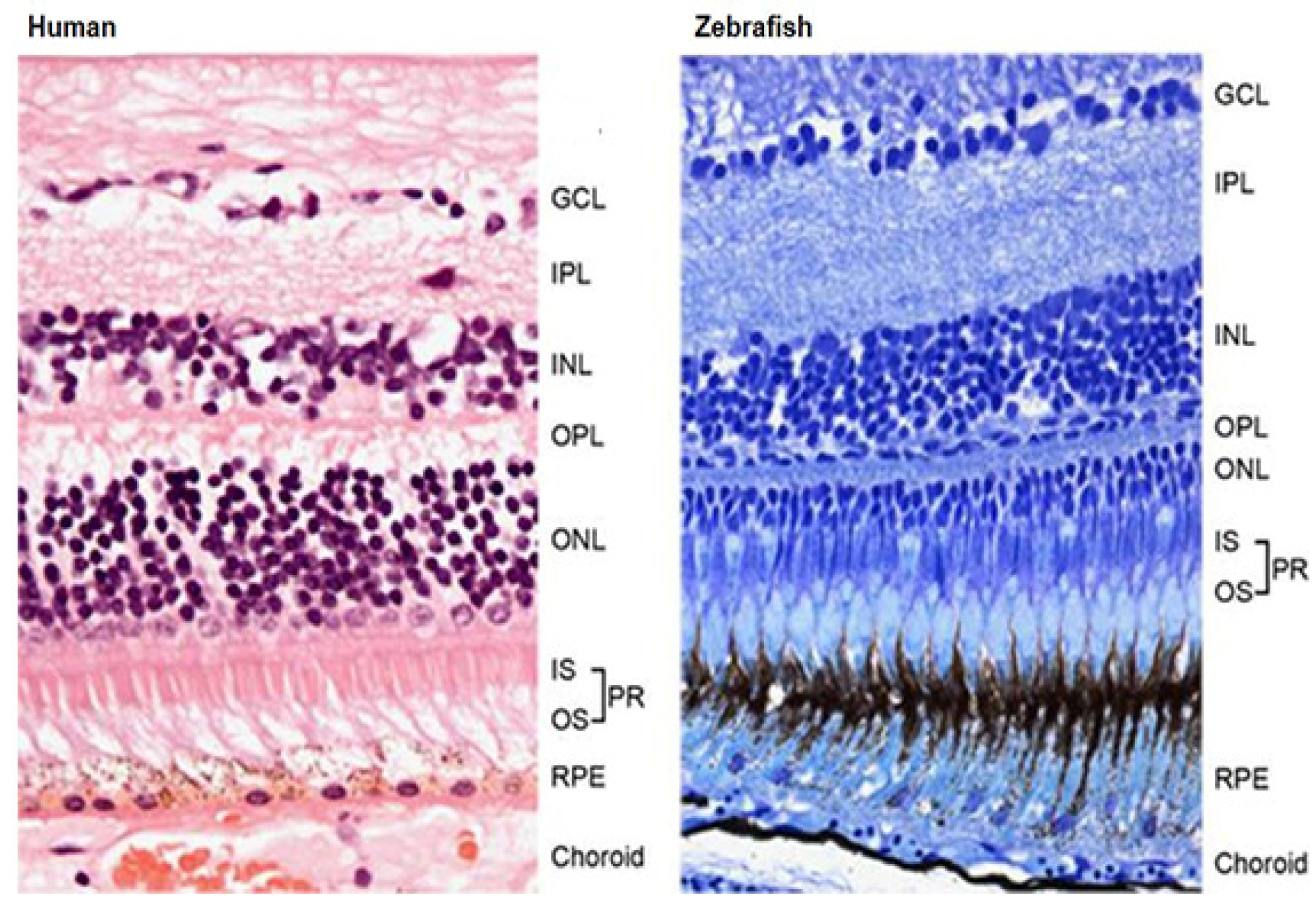 Layers of the Retina - Discovery Eye Foundation