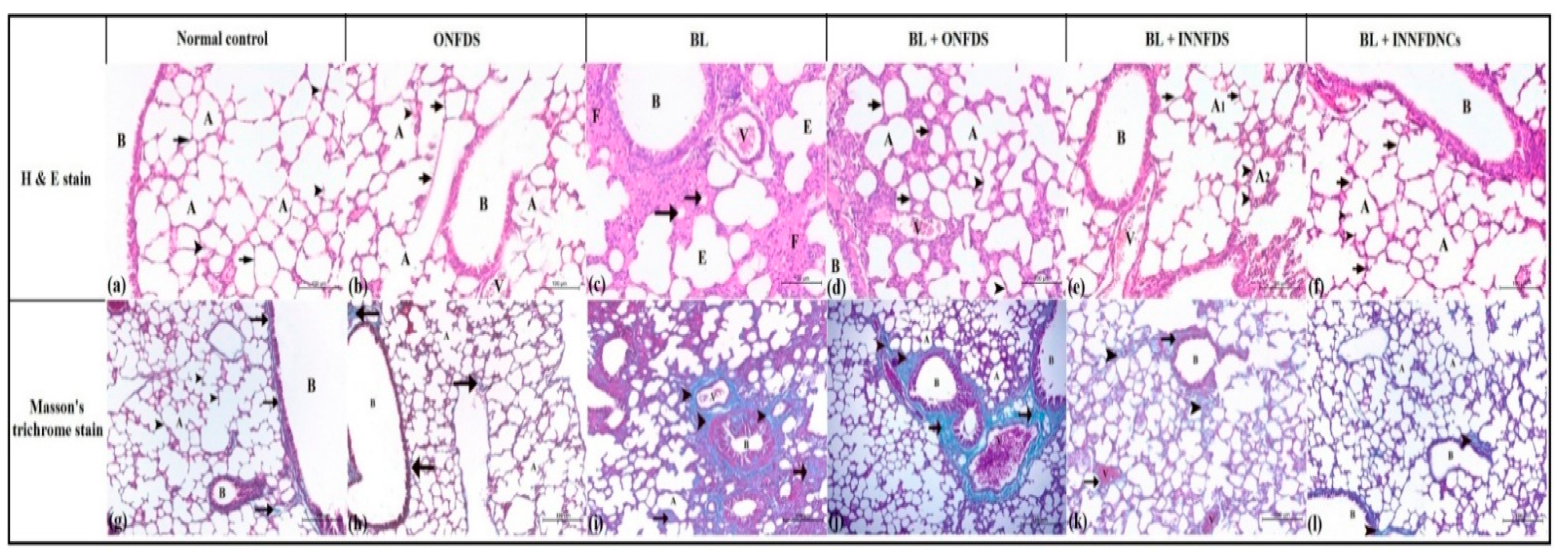 Pharmaceuticals 14 01225 g007