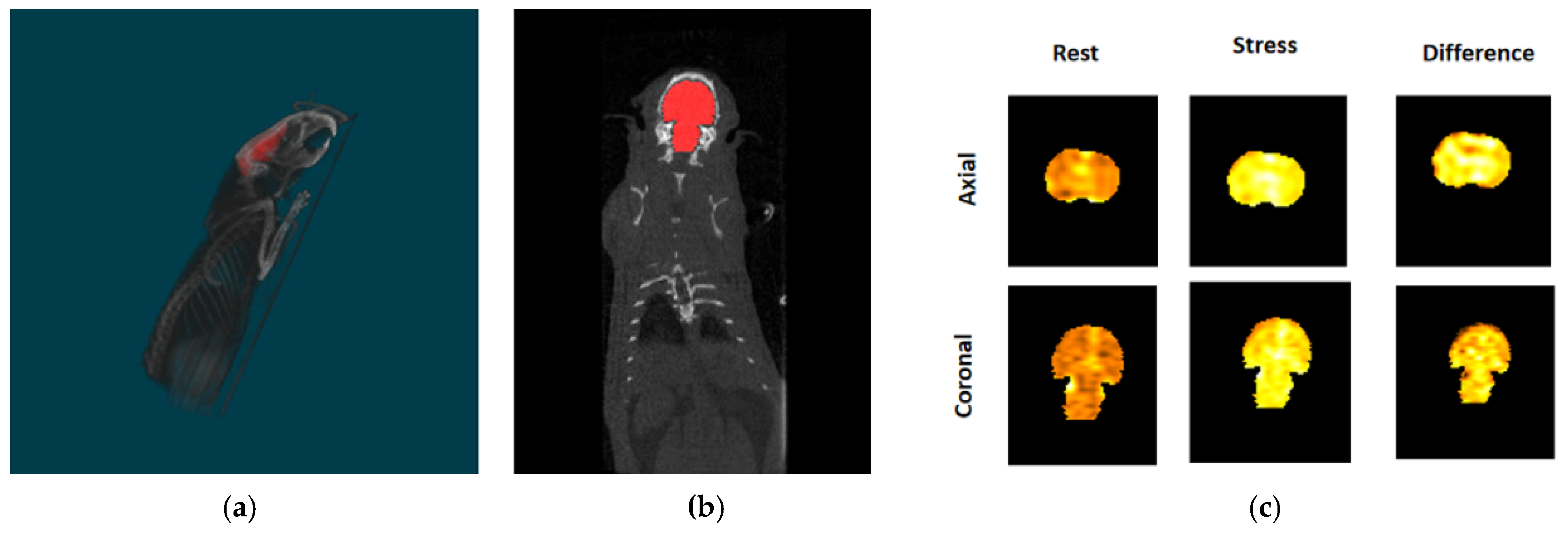 High-resolution micro-CT for 3D infarct characterization and segmentation  in mice stroke models