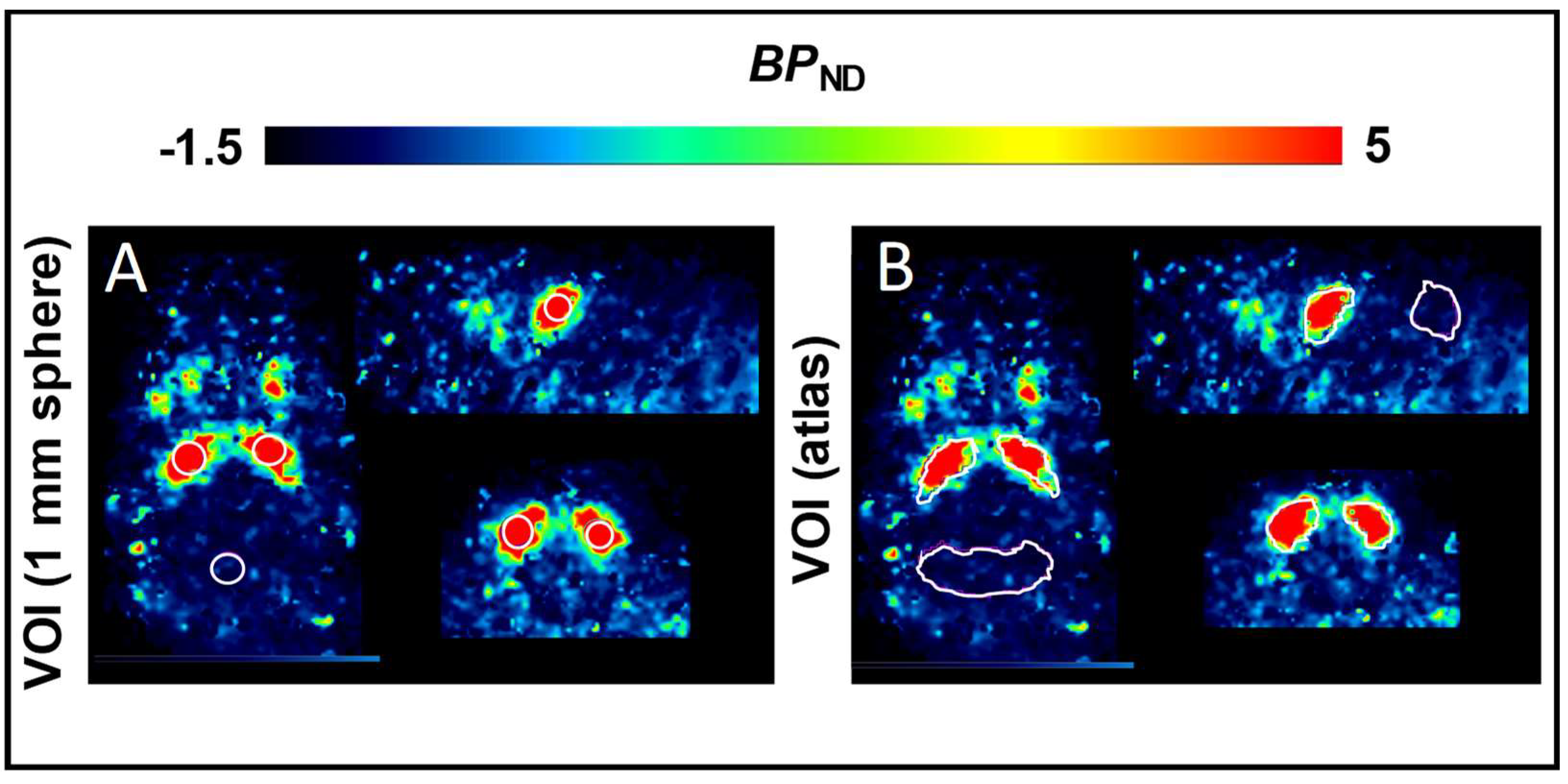 Pharmaceuticals | Free Full-Text | Quantitation of the A2A Adenosine  Receptor Density in the Striatum of Mice and Pigs with [18F]FLUDA by  Positron Emission Tomography