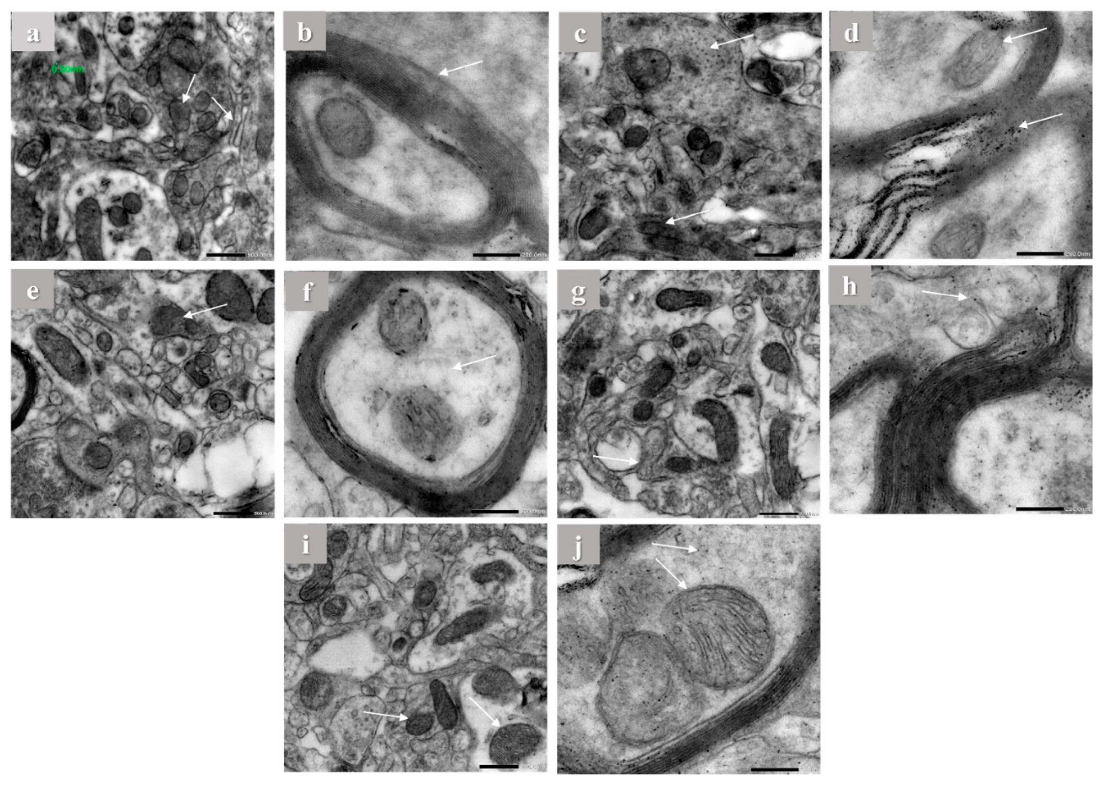 Pharmaceuticals 16 00012 g005