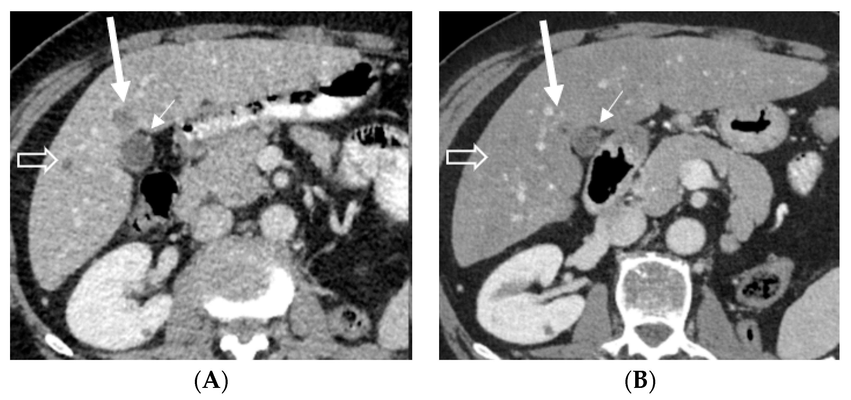 Pharmaceuticals 16 00375 g003 Pharmaceuticals 16 00375 g003