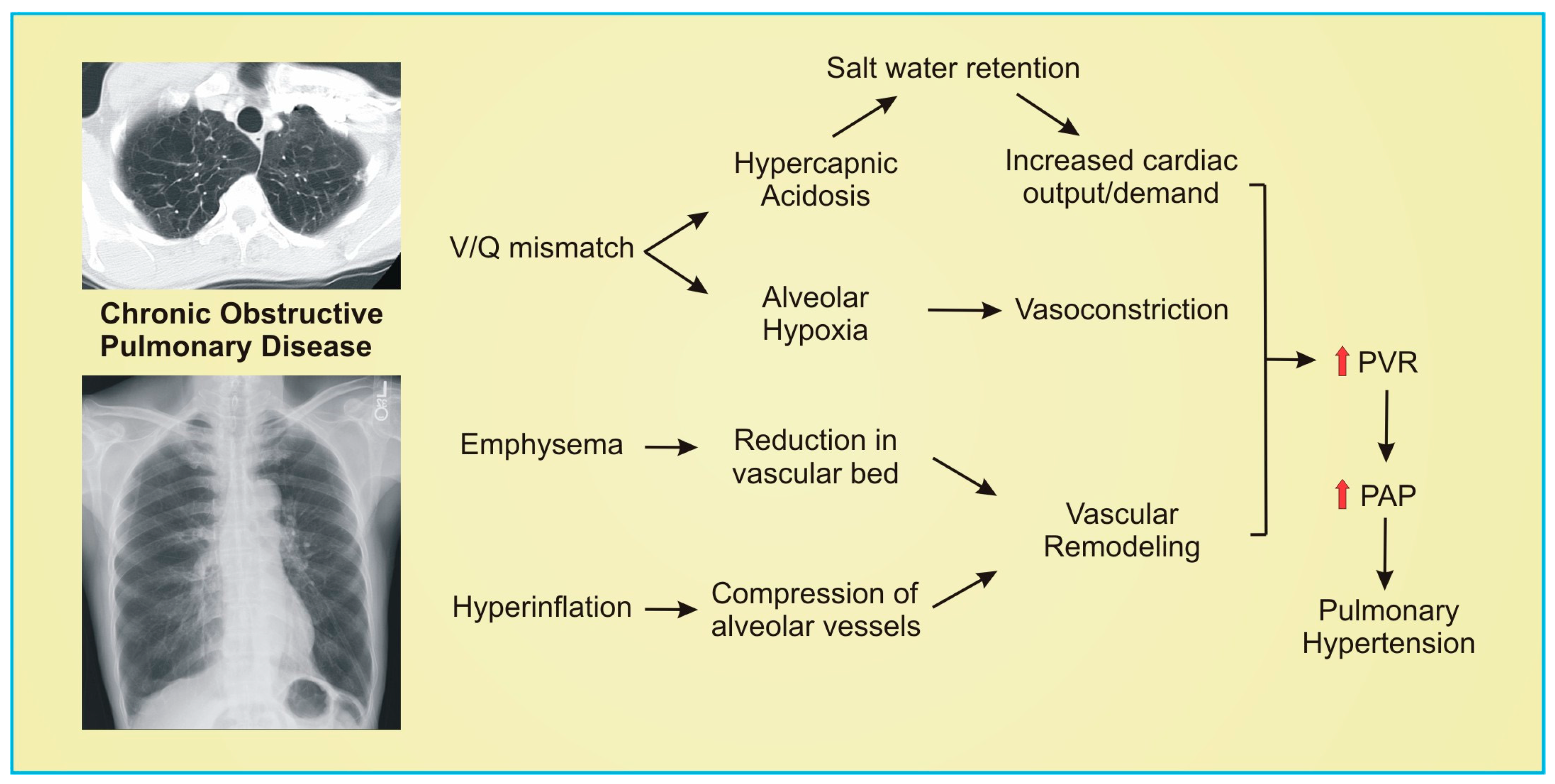 Pharmaceuticals | Free Full-Text | Pharmacology and Emerging Therapies