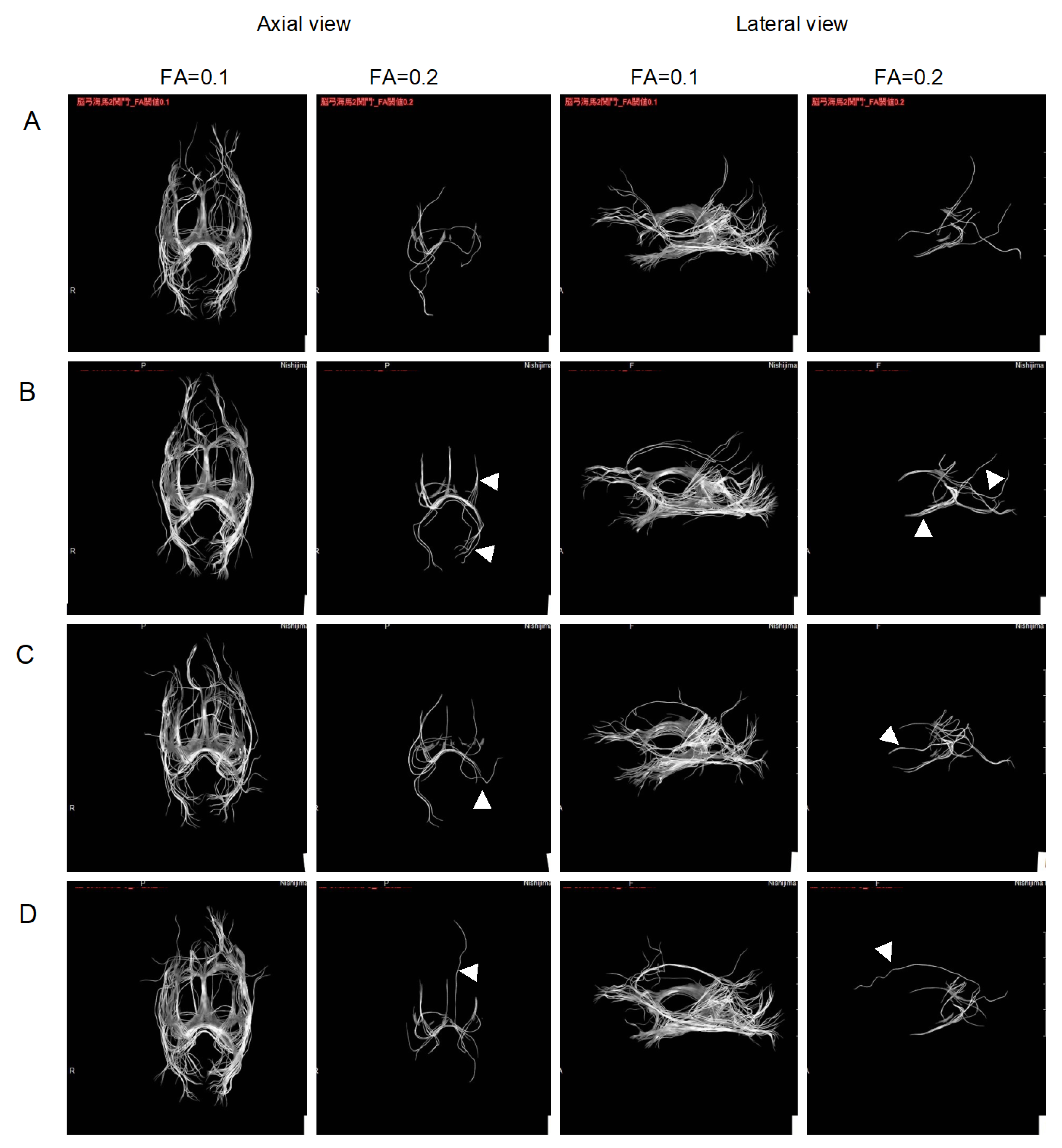 Pharmaceuticals 16 00434 g003b