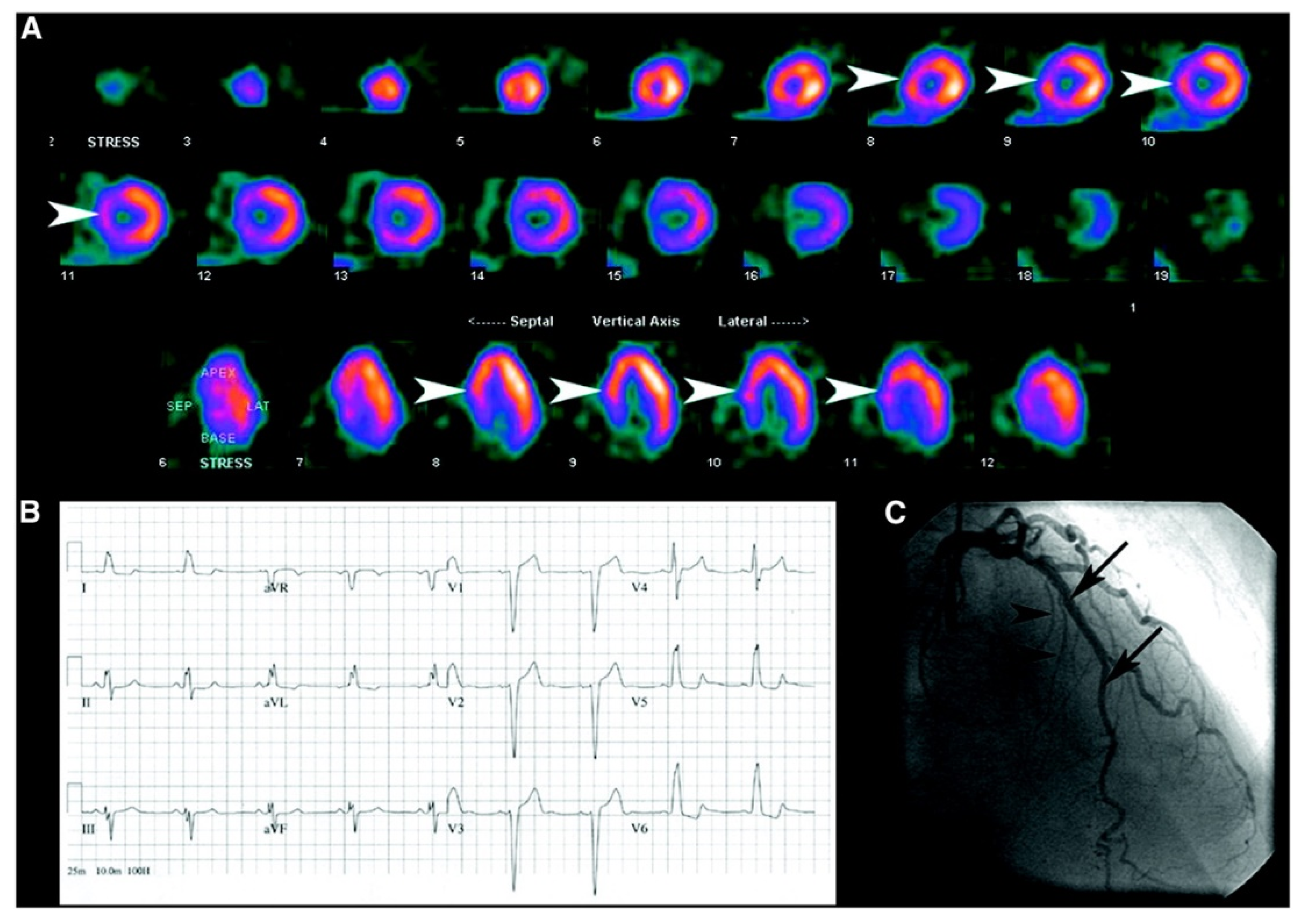 pharmaceuticals-free-full-text-medication-and-ecg-patterns-that-may