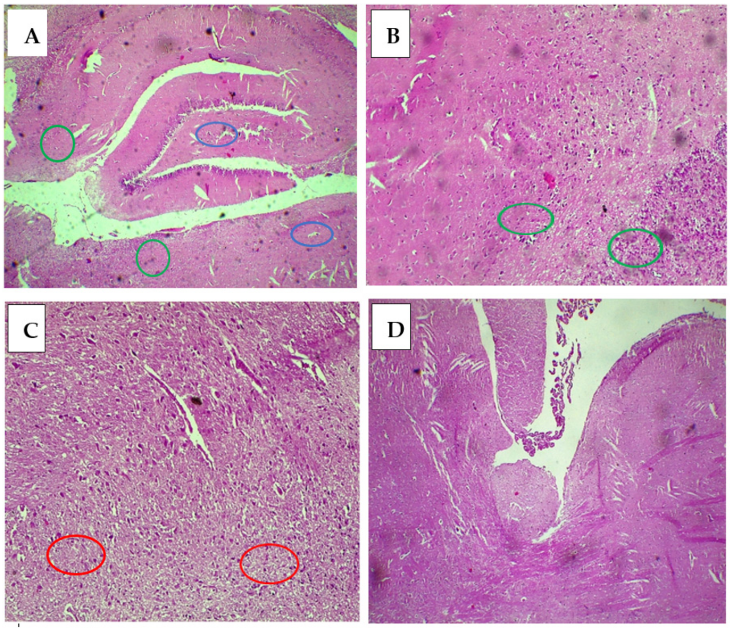 Pharmaceuticals 18 00509 g011