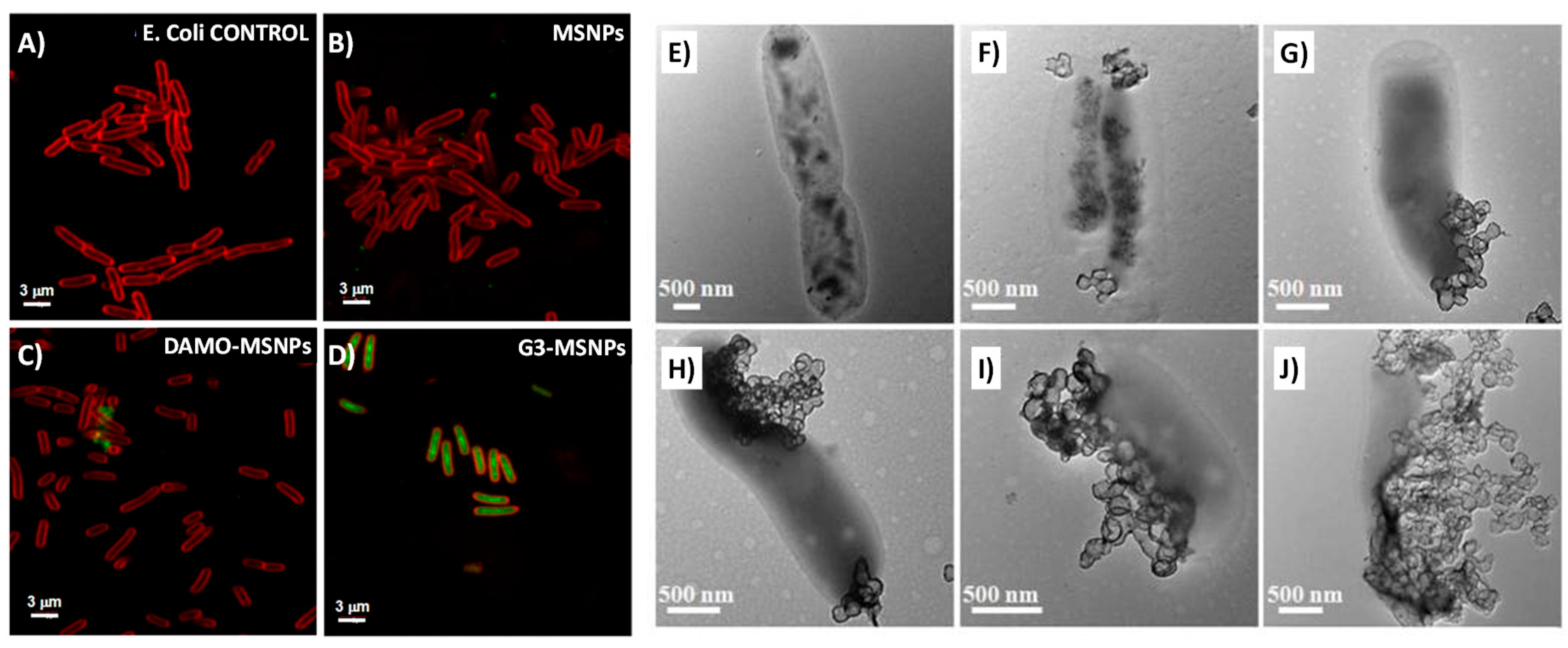 Pharmaceutics Free Full Text Mesoporous Silica Materials As Drug Delivery The Nightmare Of Bacterial Infection Html