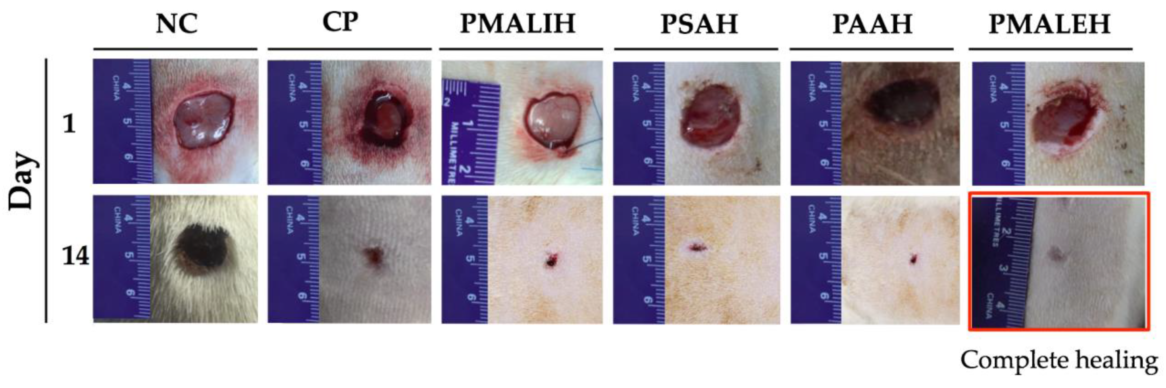 Pharmaceutics | Free Full-Text | Film Dressings Based on Hydrogels ...