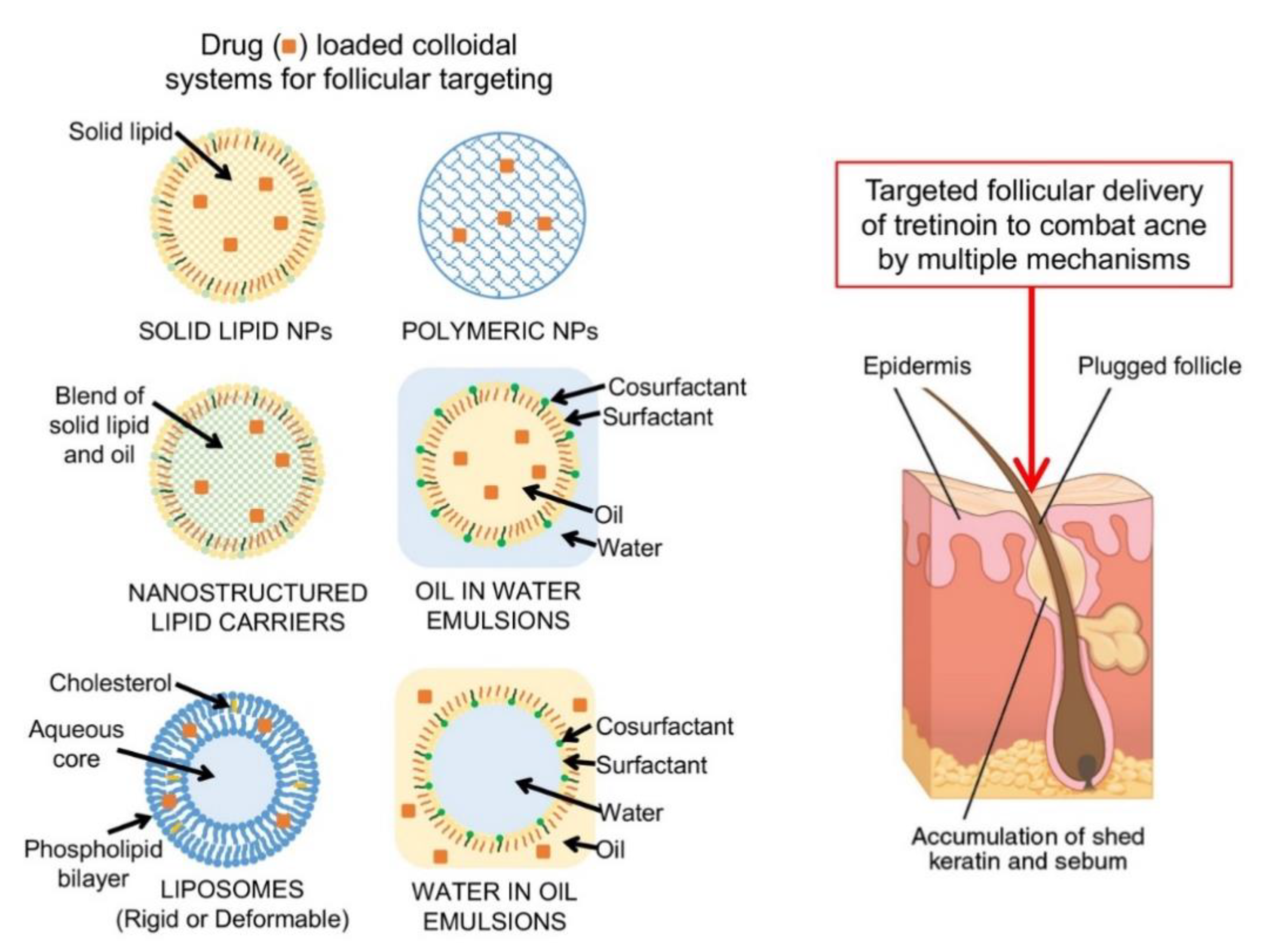 Pharmaceutics | Free Full-Text | Targeted Topical Delivery of Retinoids in  the Management of Acne Vulgaris: Current Formulations and Novel Delivery  Systems | HTML