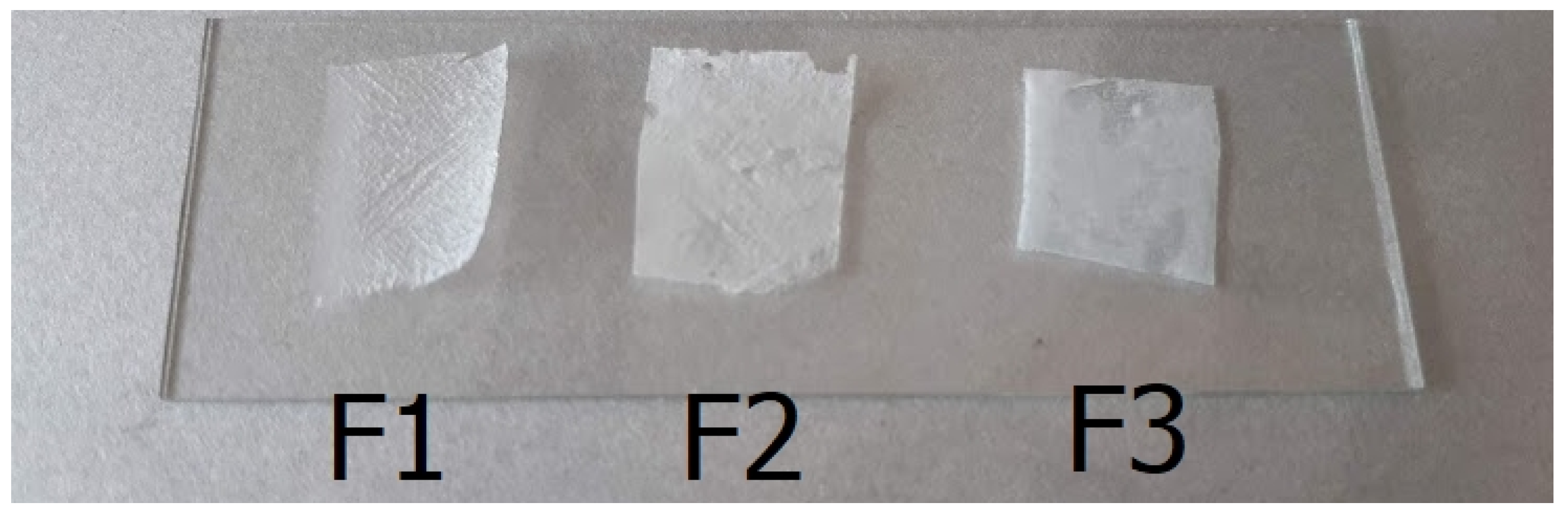 Silinject, Seringue permettant d'injecter du silicone pour réaliser des  orthoplasties en charge, J3M DIFFUSION, Podiatech