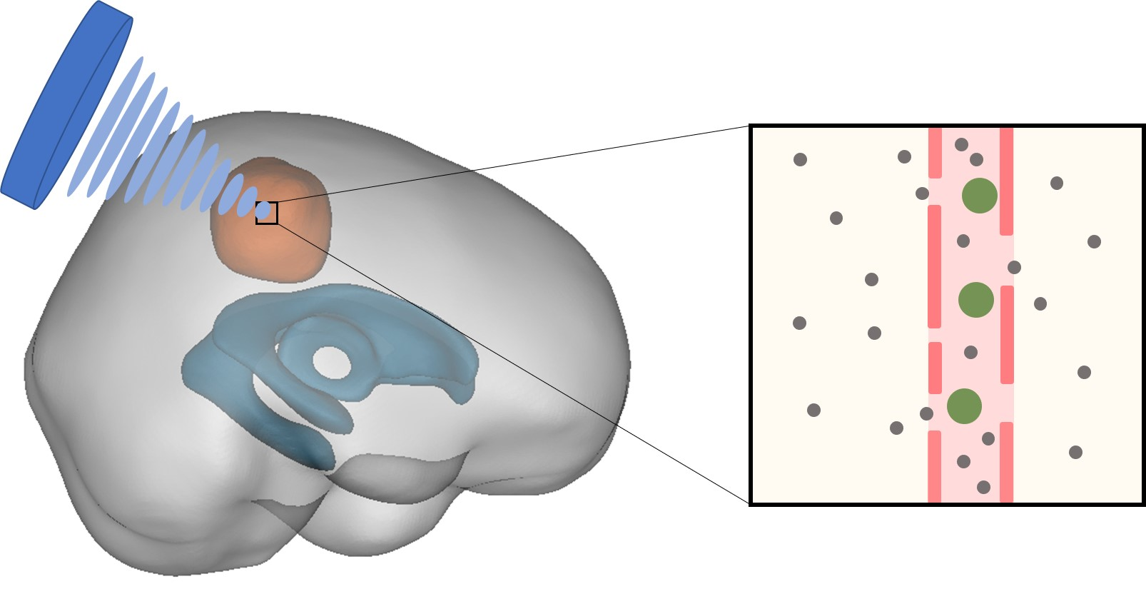 Pharmaceutics Free FullText Effects of Focused