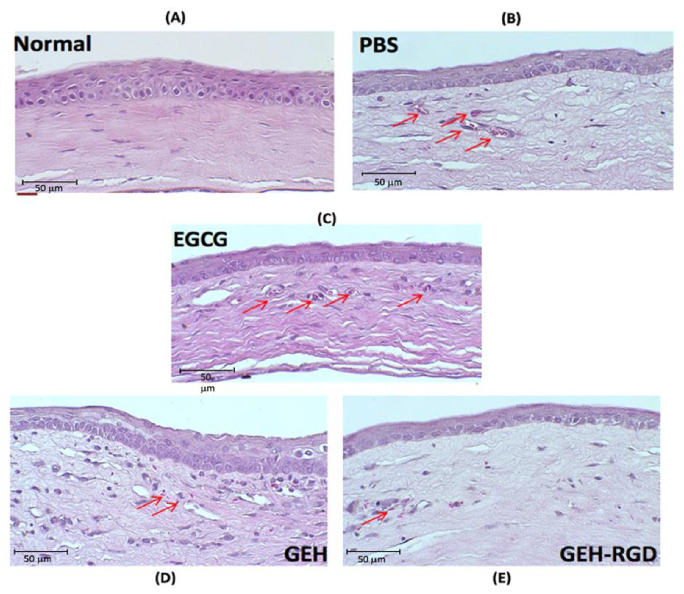 Pharmaceutics 12 00404 g005