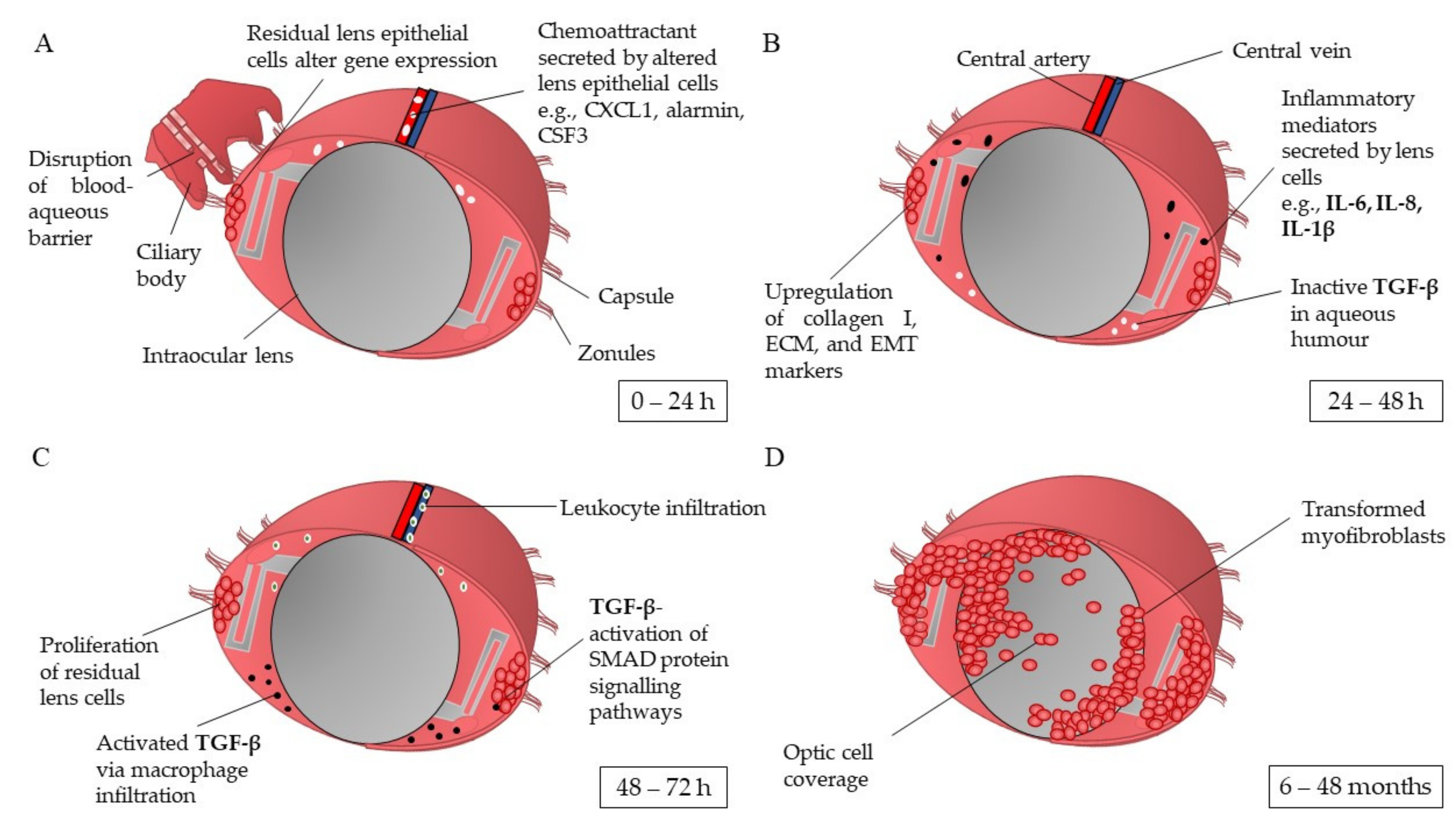 Pharmaceutics | Free Full-Text | Opacification Factors of the Lens Materials Affecting Capsule Intraocular Development Posterior in