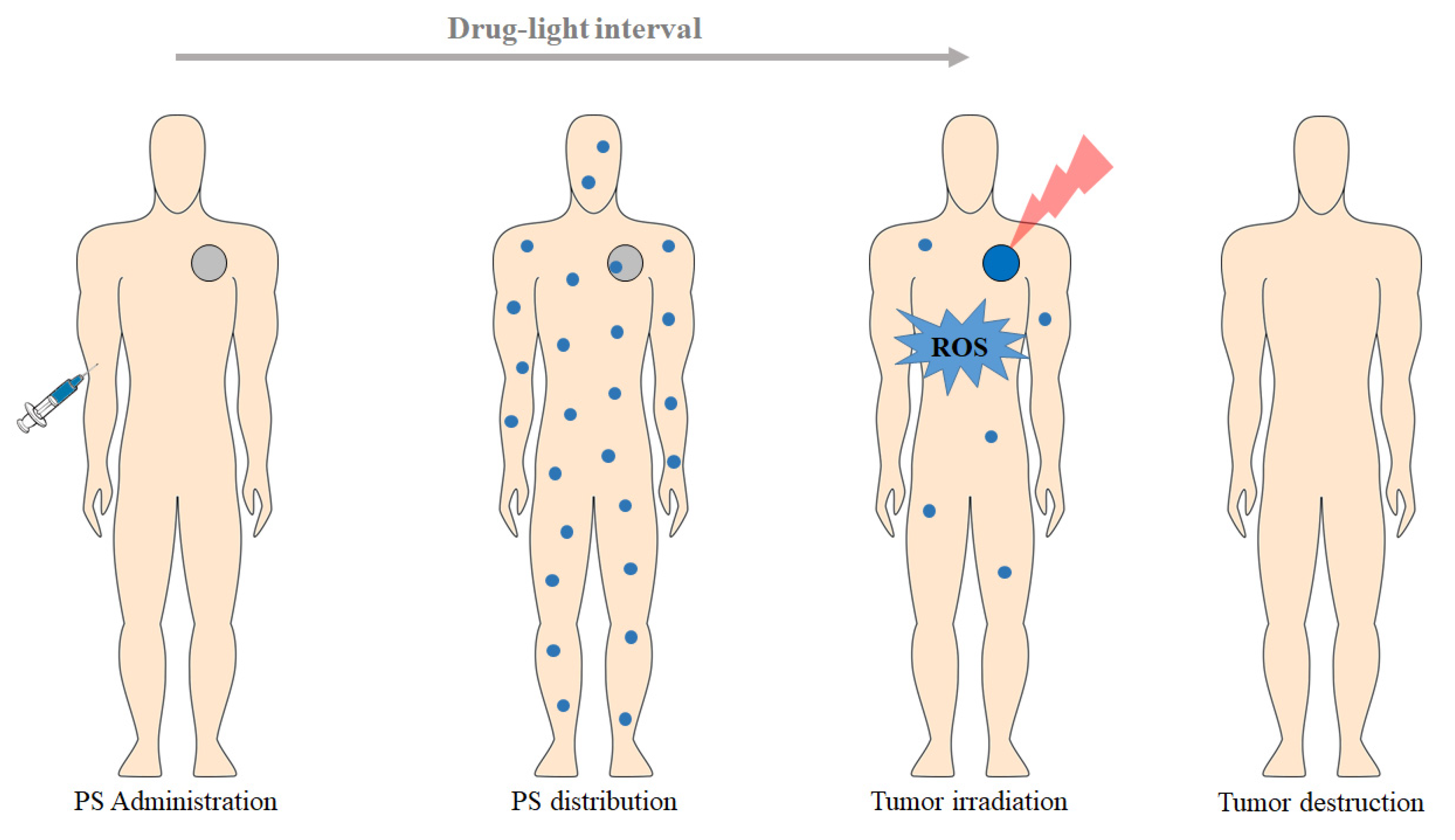 Pharmaceutics Free Full Text Photodynamic Therapy Review