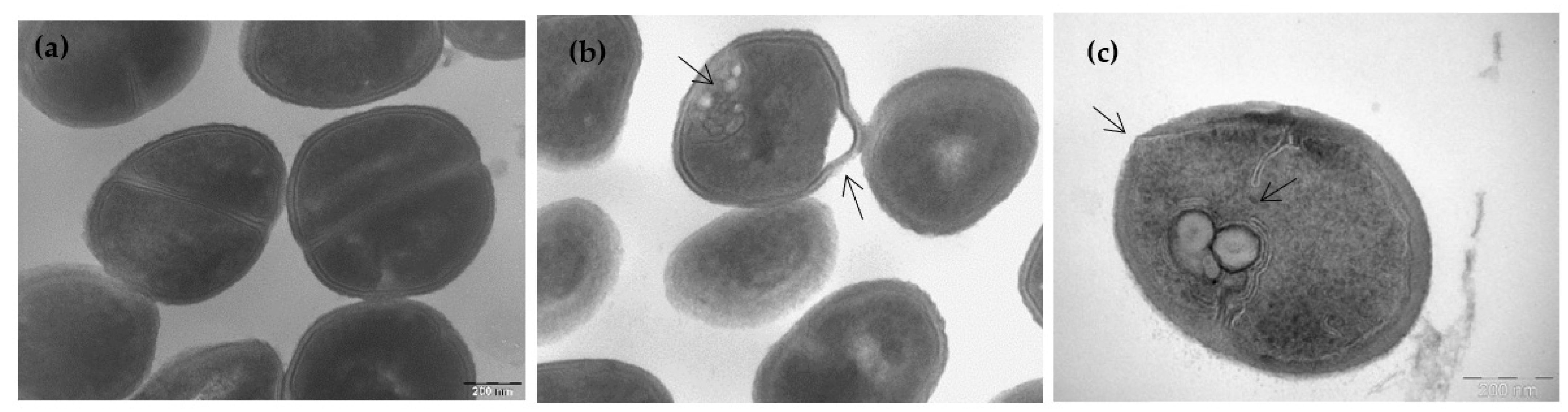Pharmaceutics 13 02180 g004 Pharmaceutics 13 02180 g004