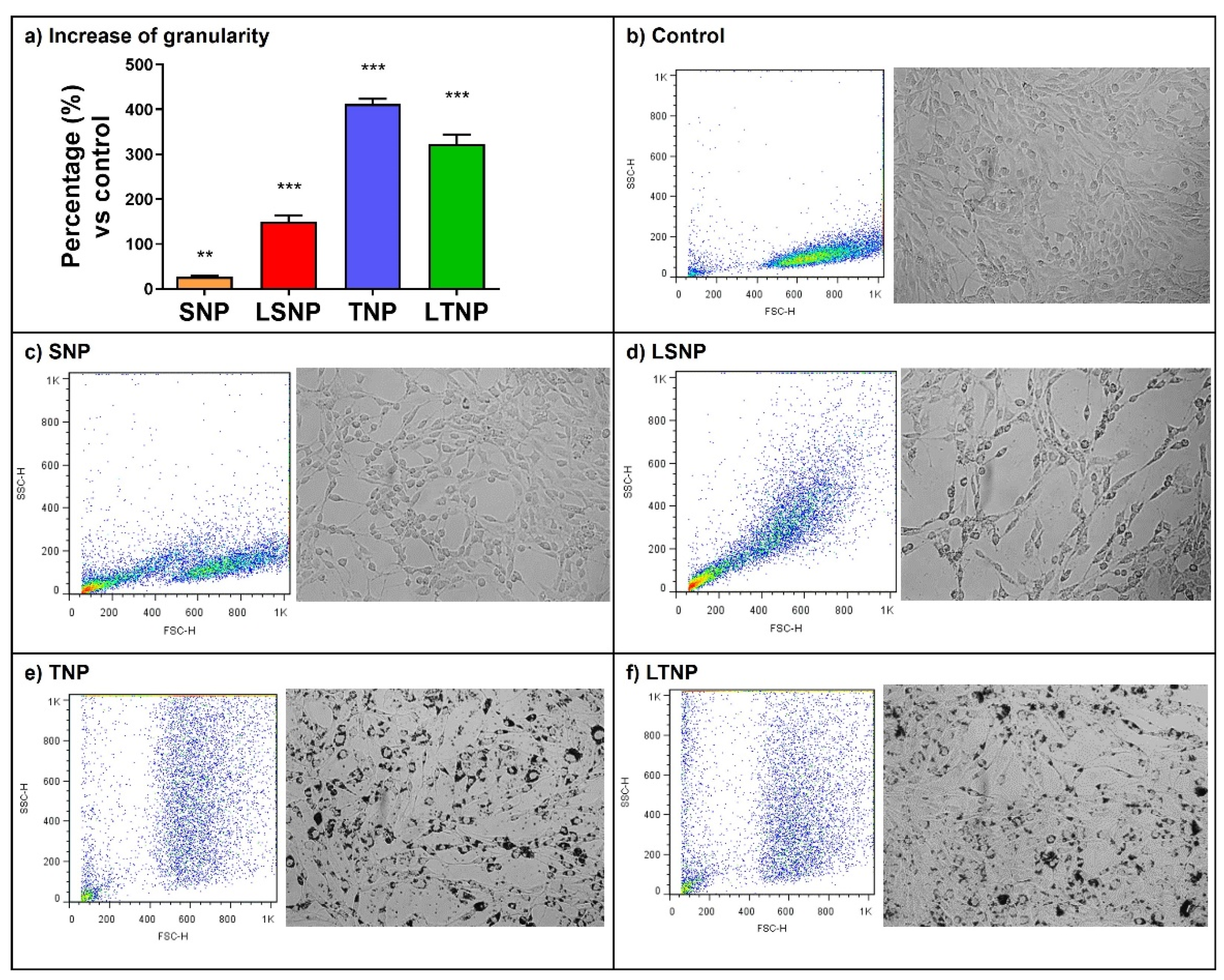 Pharmaceutics Free Full Text Lactate Loaded Nanoparticles Induce Glioma Cytotoxicity And Increase The Survival Of Rats Bearing Malignant Glioma Brain Tumor Html