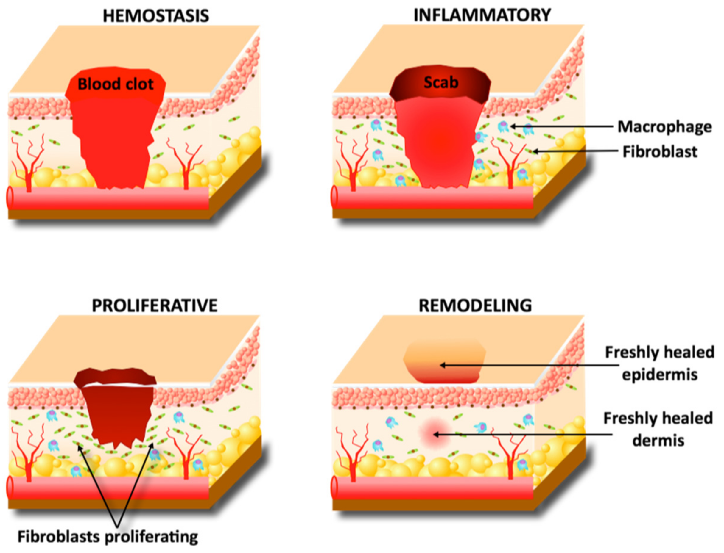 Pharmaceutics | Free Full-Text | Advancements in Skin Delivery of ...