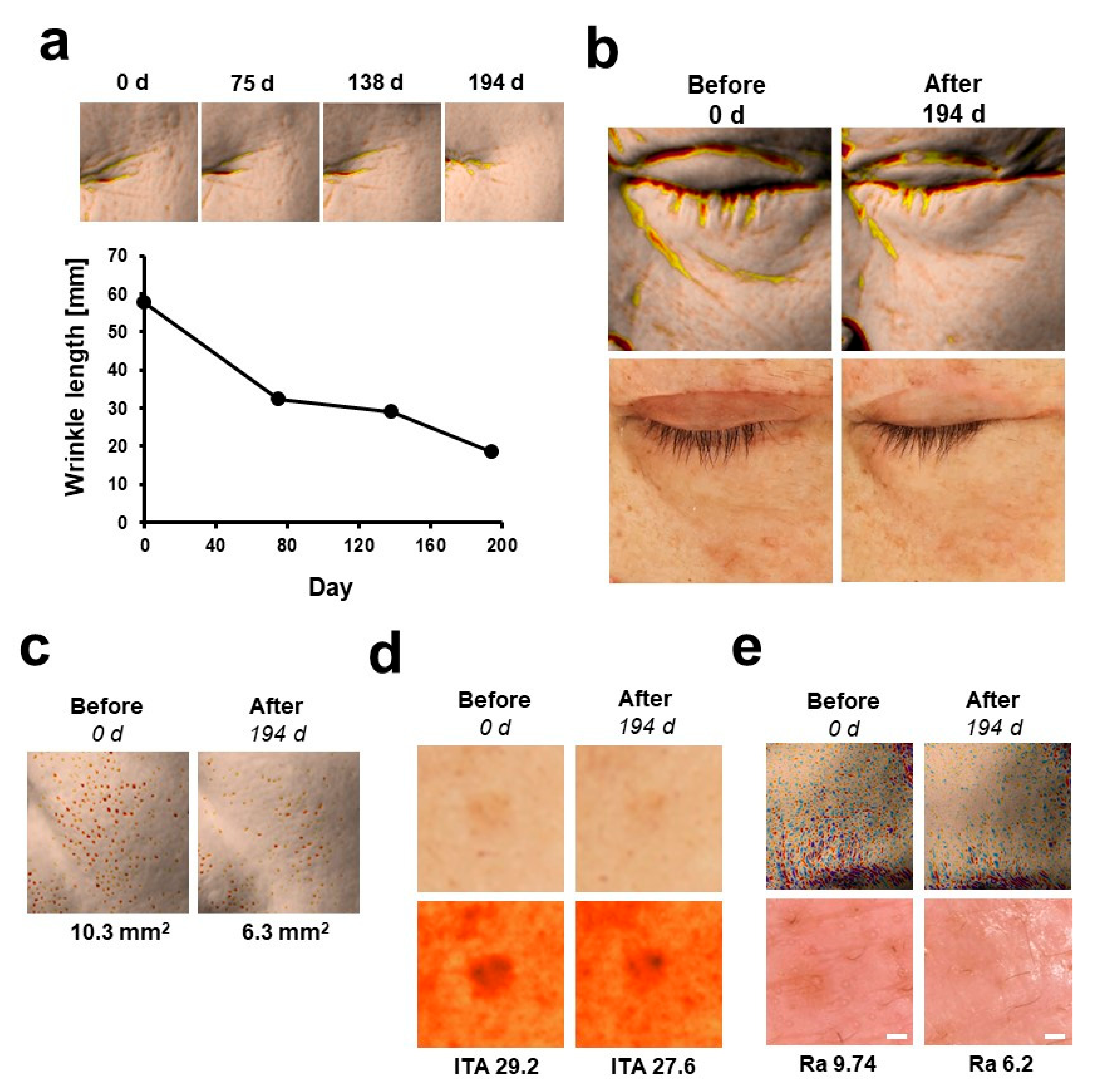 Pharmaceutics | Free Full-Text | Enhancement of Efficacy of Retinoids  through Enhancing Retinoid-Induced RAR Activity and Inhibiting  Hydroxylation of Retinoic Acid, and Its Clinical Efficacy on Photo-Aging