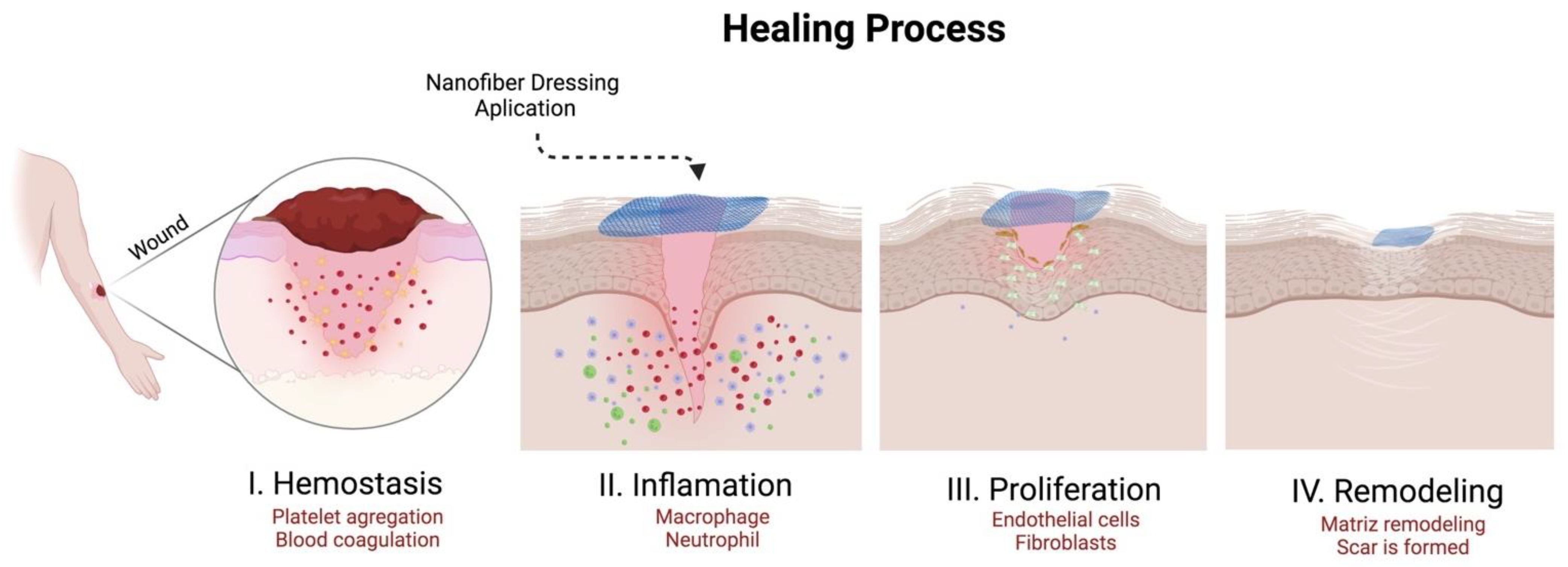 To the point: Mini-needles may help smart bandages better heal wounds, Nebraska Today