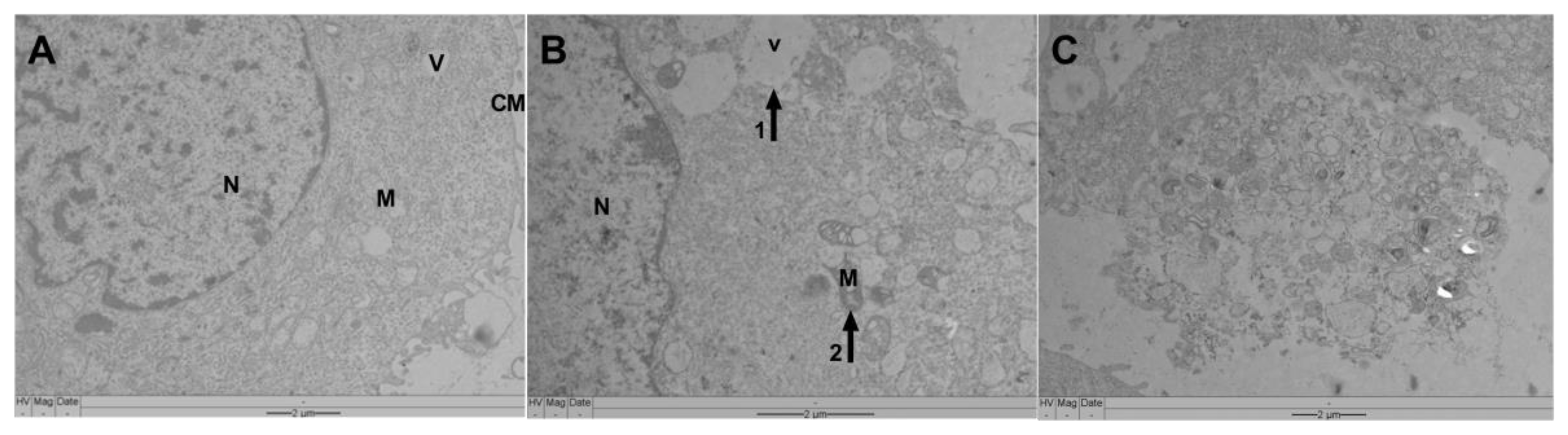 Pharmaceutics 14 02775 g009 Pharmaceutics 14 02775 g009