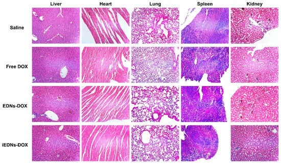 Pharmaceutics Free Full Text Tumor Targeted Erythrocyte Membrane