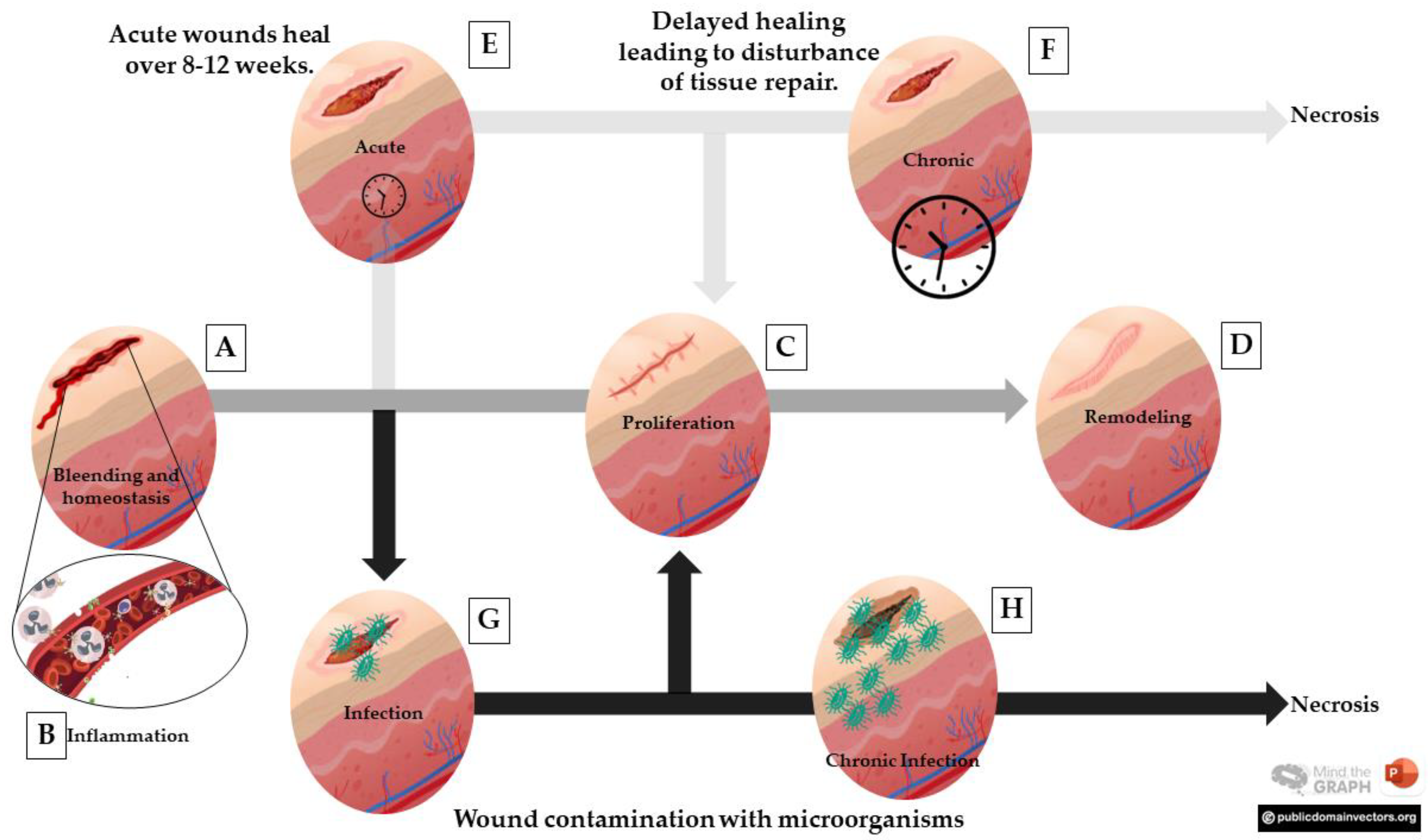 Wound contraction in the HG, LG and SG at 3, 7 and 14 PO days. Note