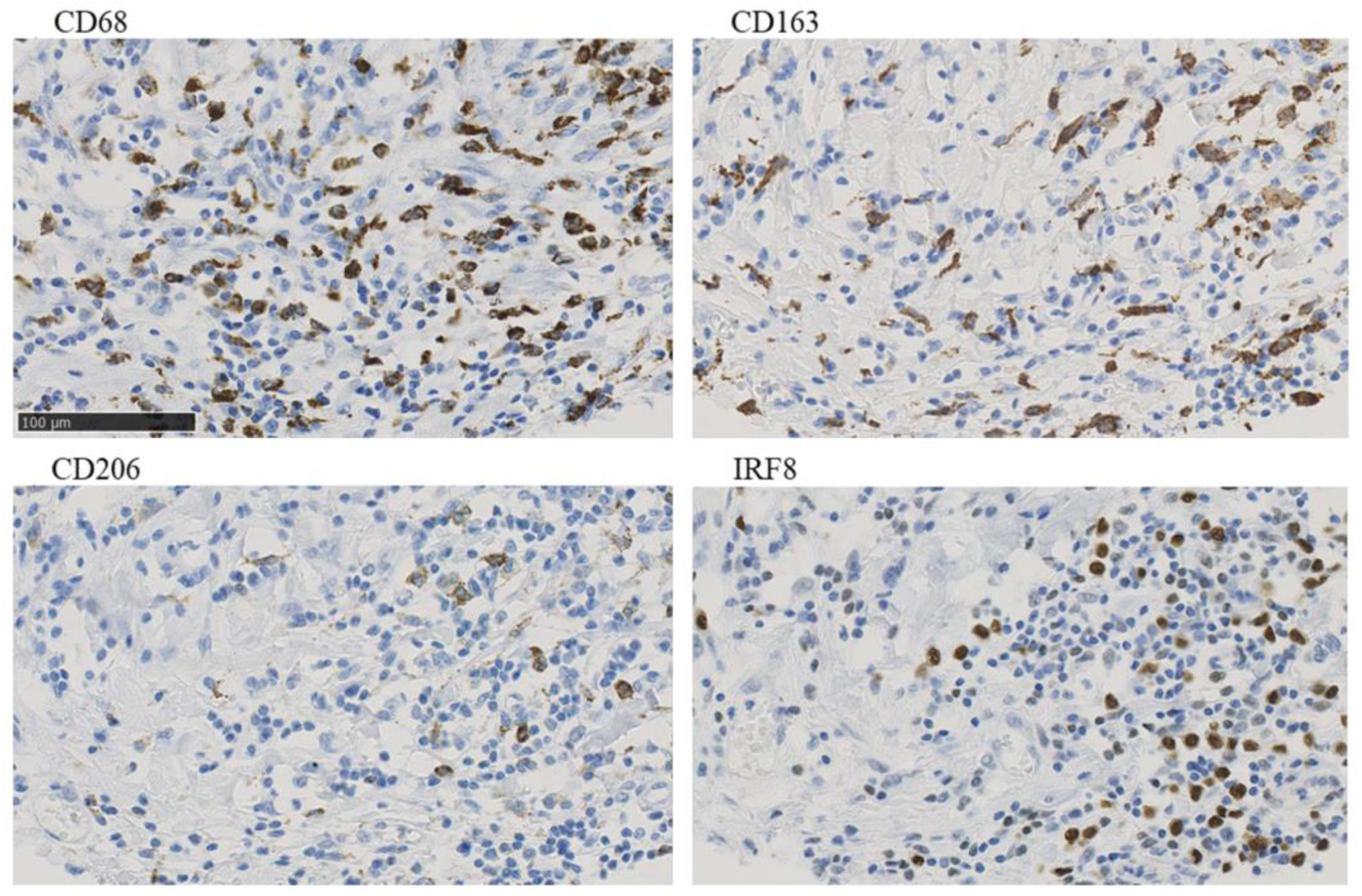 Breast cancer evaluation by fluorescent dot detection using combined  mathematical morphology and multifractal techniques, Diagnostic Pathology