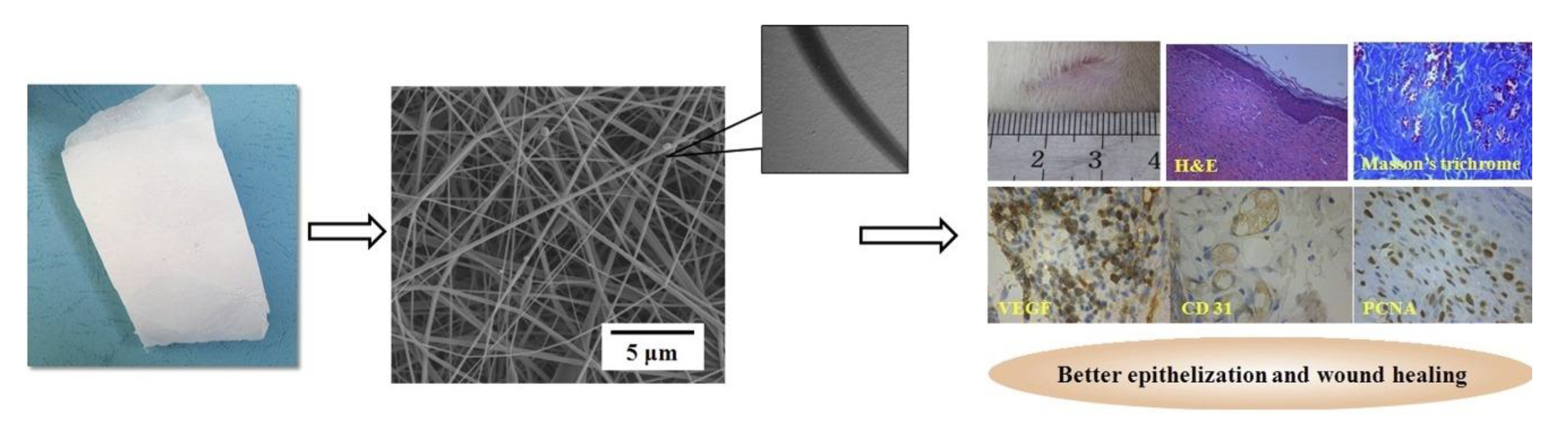 Lysozyme-loaded nanocages in a surgical glue for post-operative wound  treatment - ScienceDirect