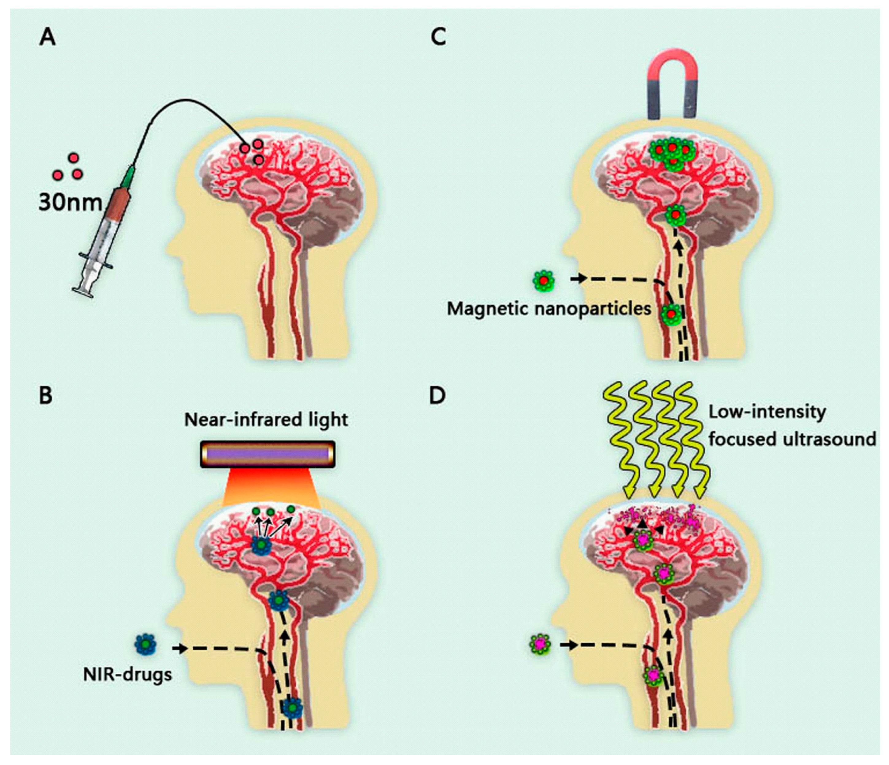 Pharmaceutics | Free Full-Text | New Insights into Alzheimer&rsquo 