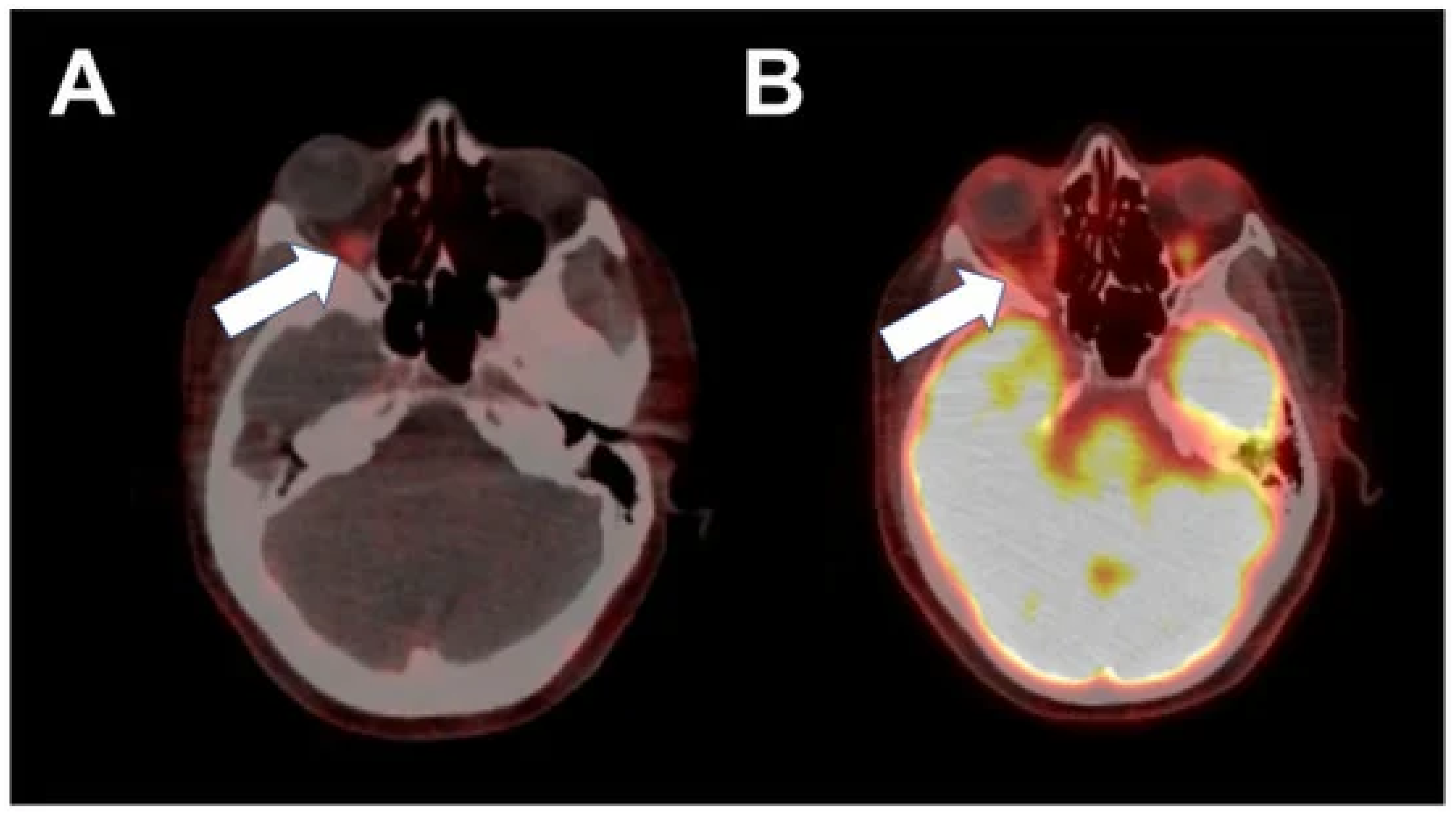 Pharmaceutics 16 00616 g001