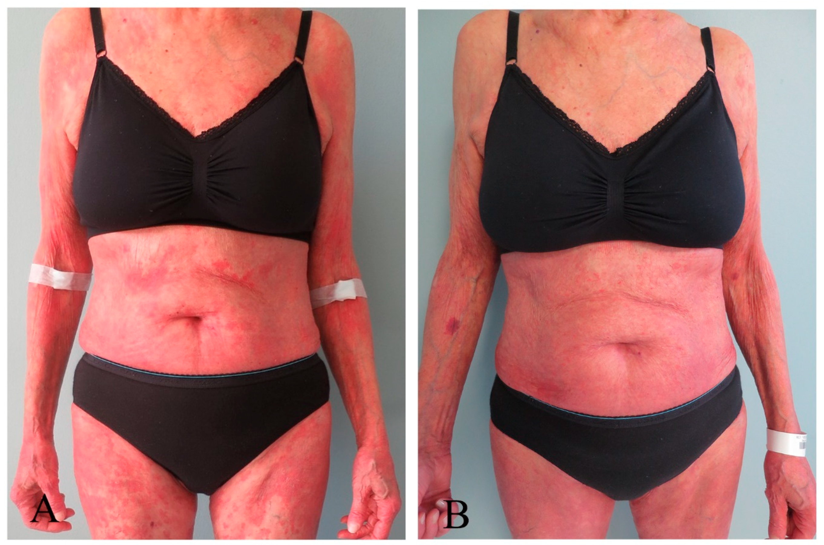 Pharmaceutics 16 00815 g001 Pharmaceutics 16 00815 g001