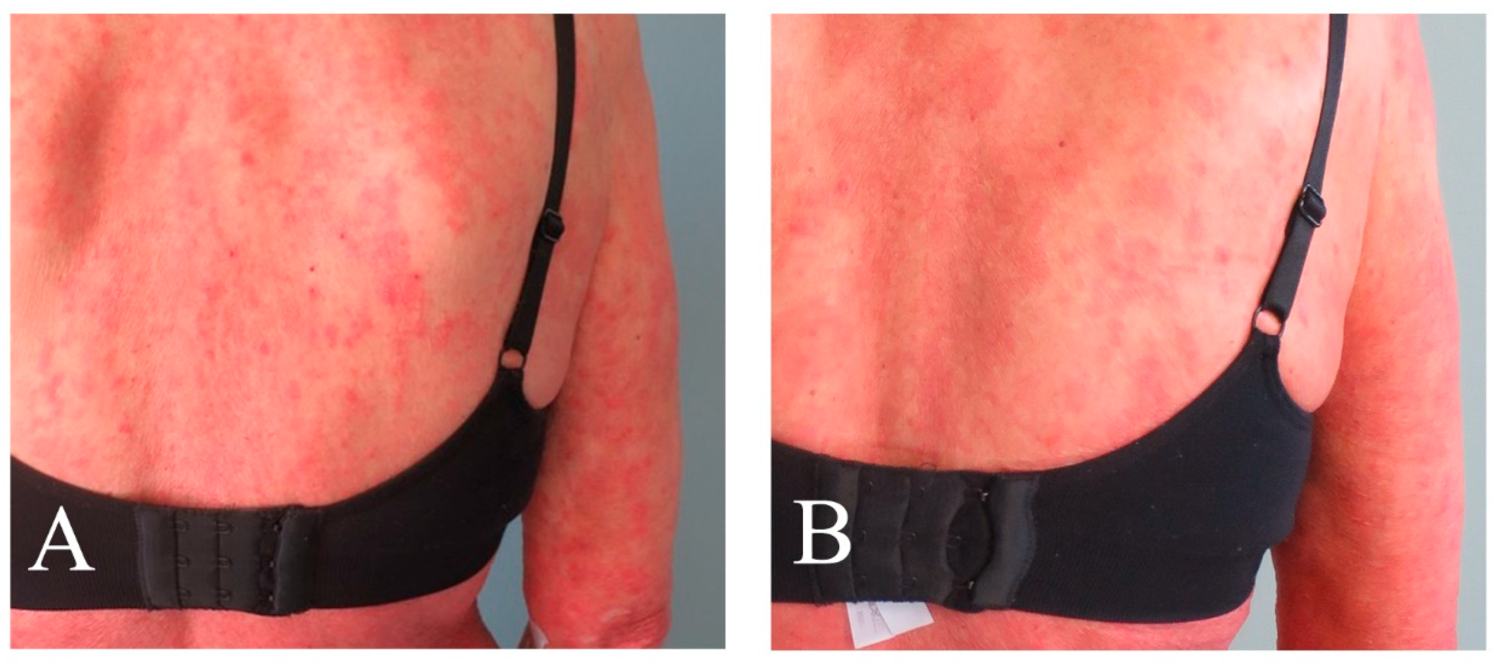 Pharmaceutics 16 00815 g002 Pharmaceutics 16 00815 g002