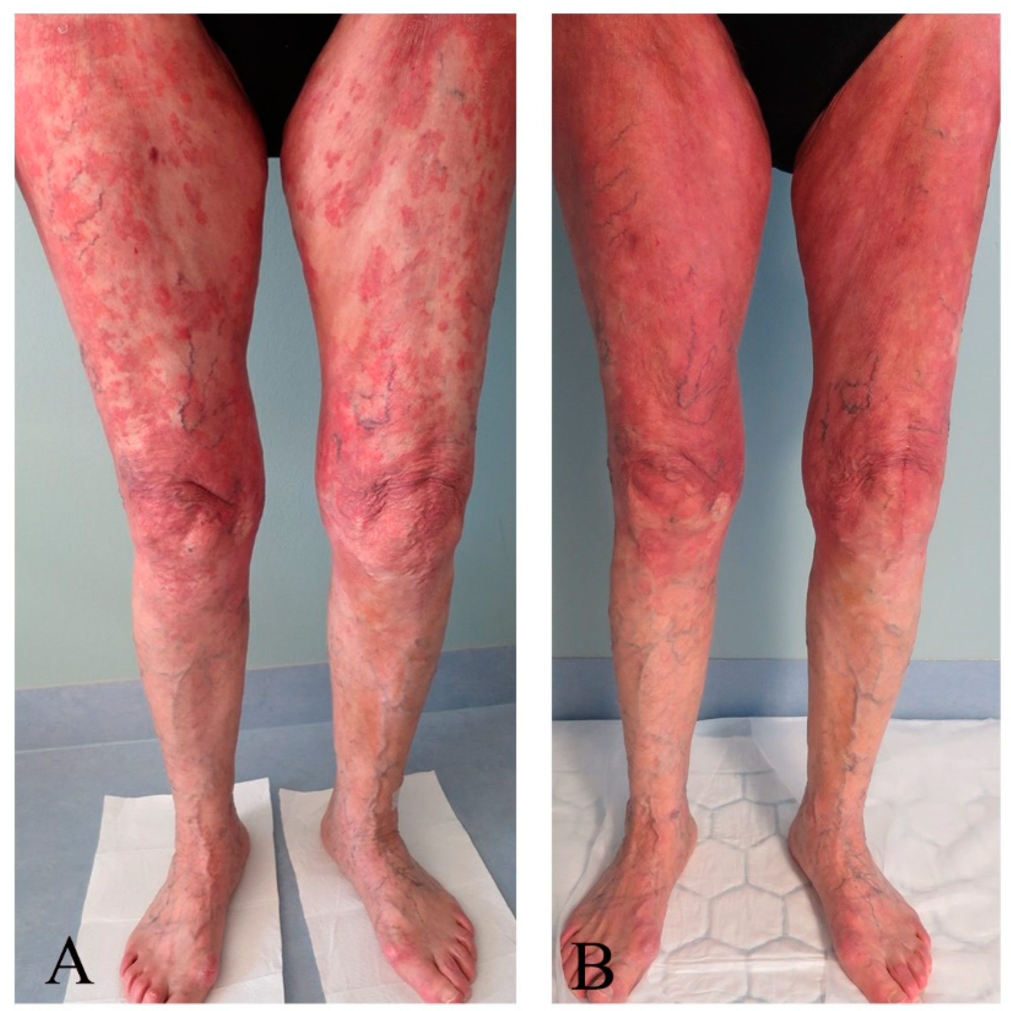 Pharmaceutics 16 00815 g003 Pharmaceutics 16 00815 g003