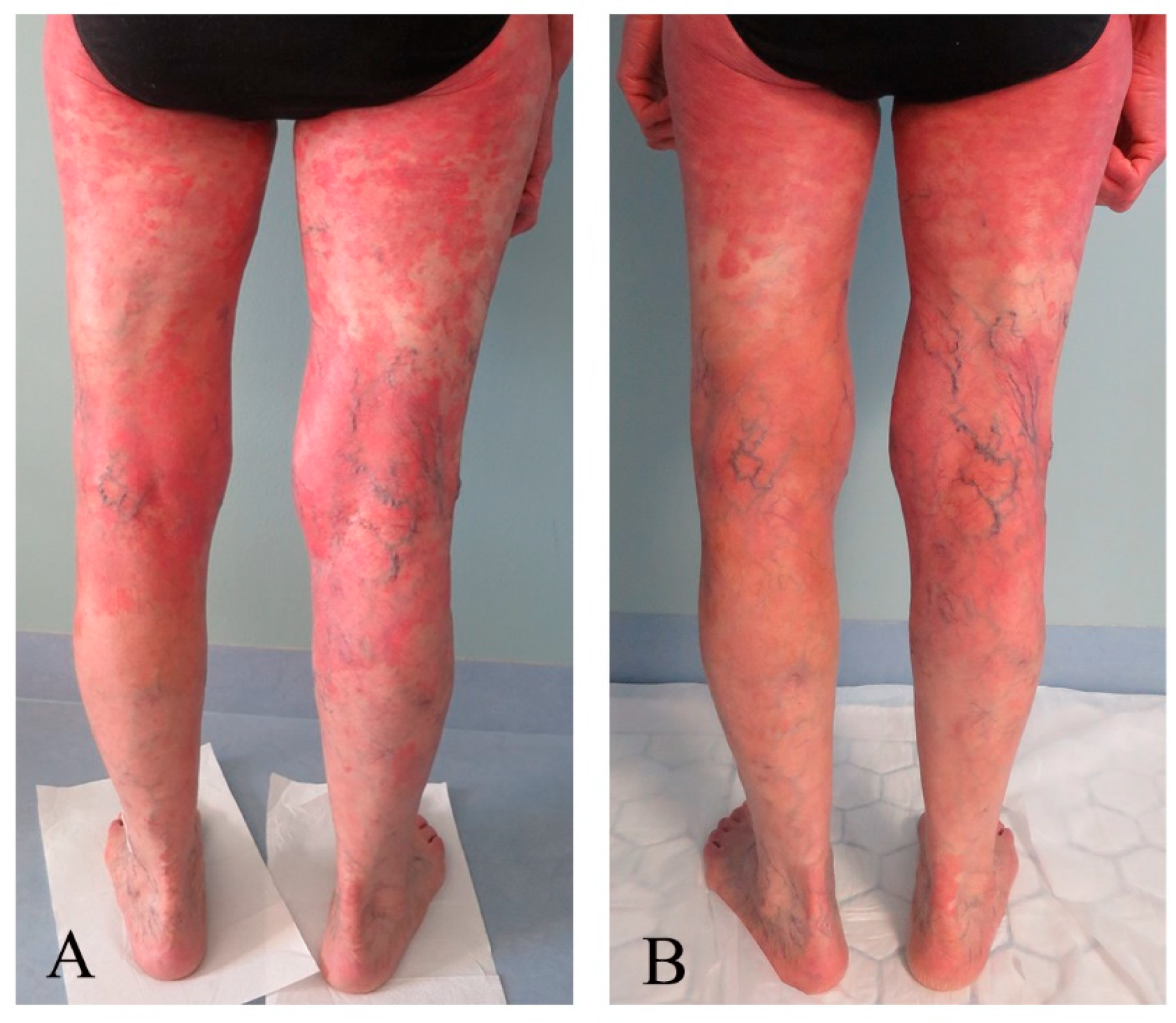 Pharmaceutics 16 00815 g004 Pharmaceutics 16 00815 g004