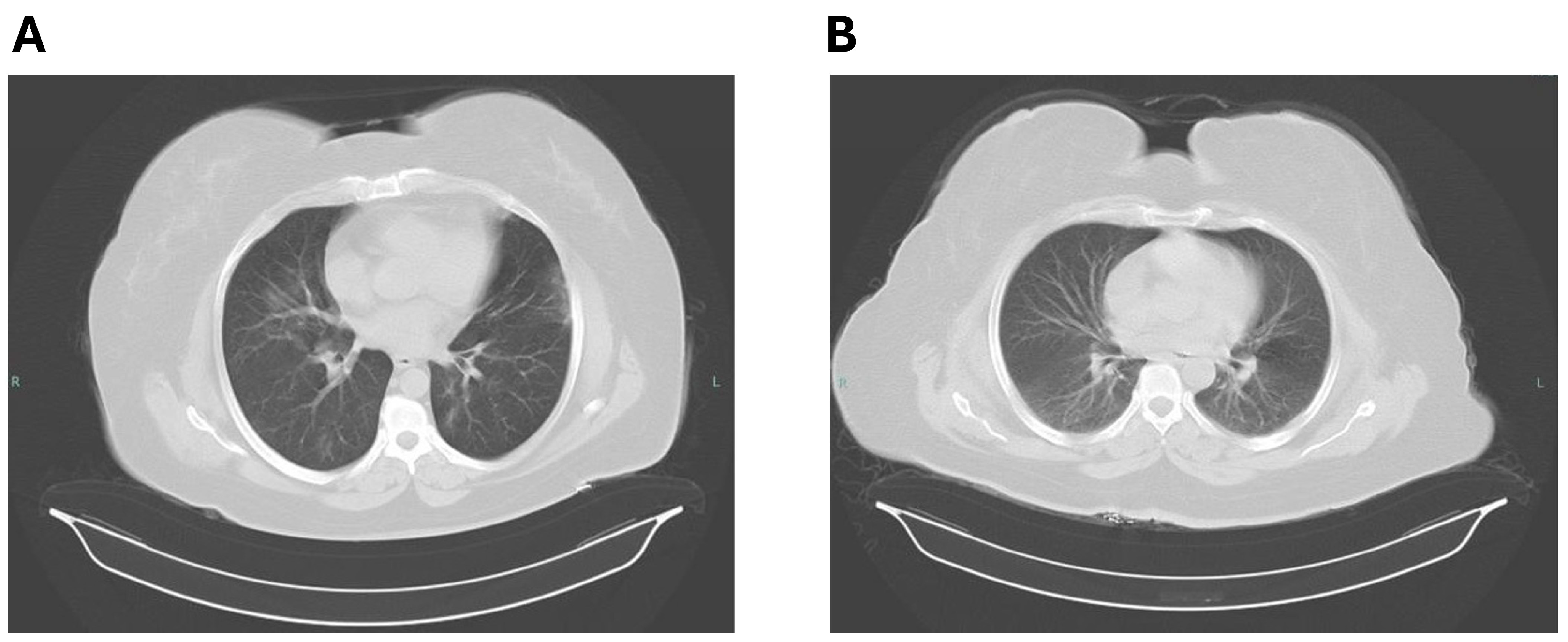 Pharmaceutics 16 00952 g001
