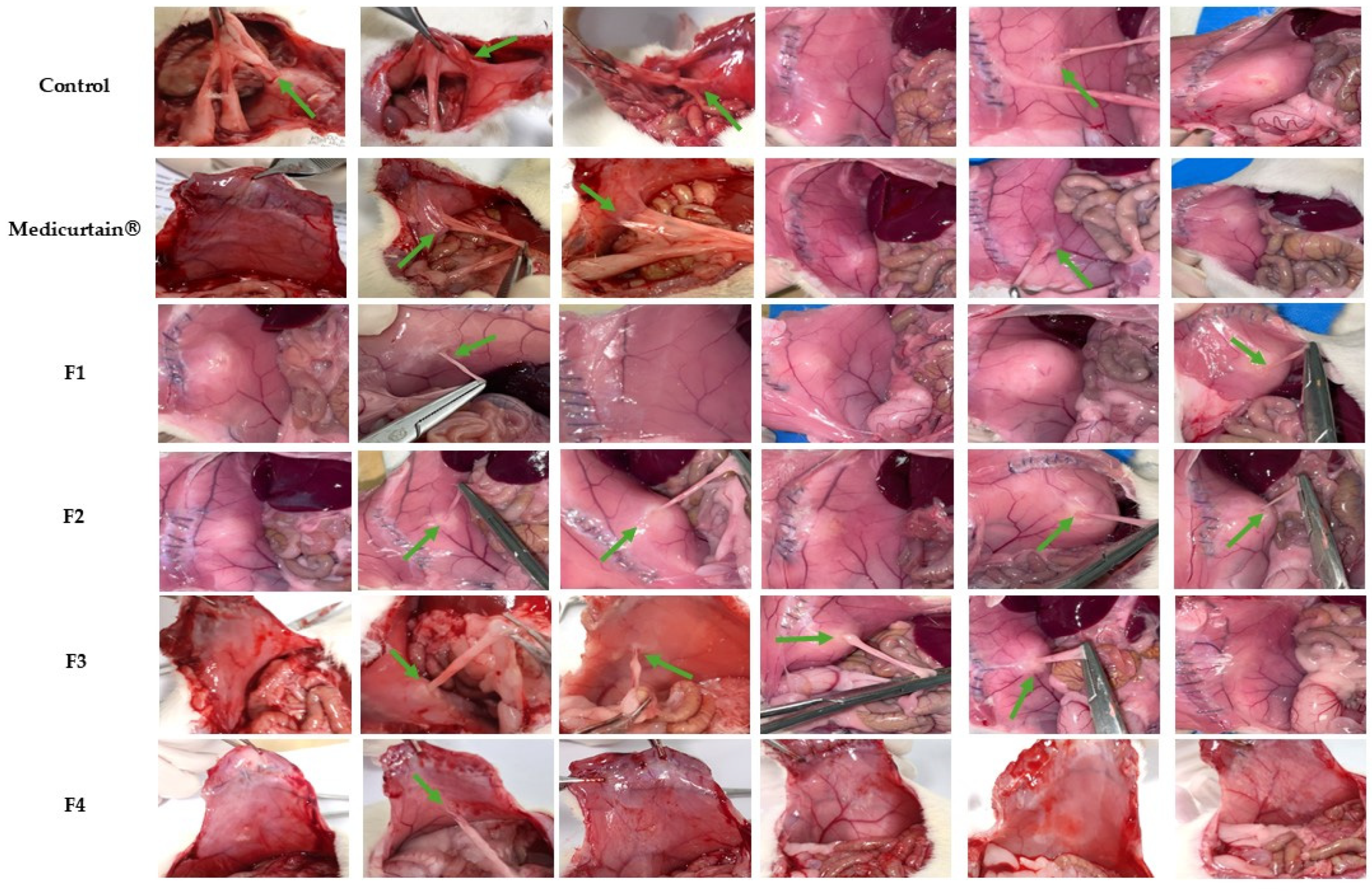 Pharmaceutics 17 00427 g006