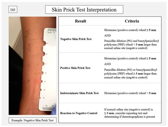 Pharmacy | Free Full-Text | Penicillin Allergy Skin Testing in the  Inpatient Setting
