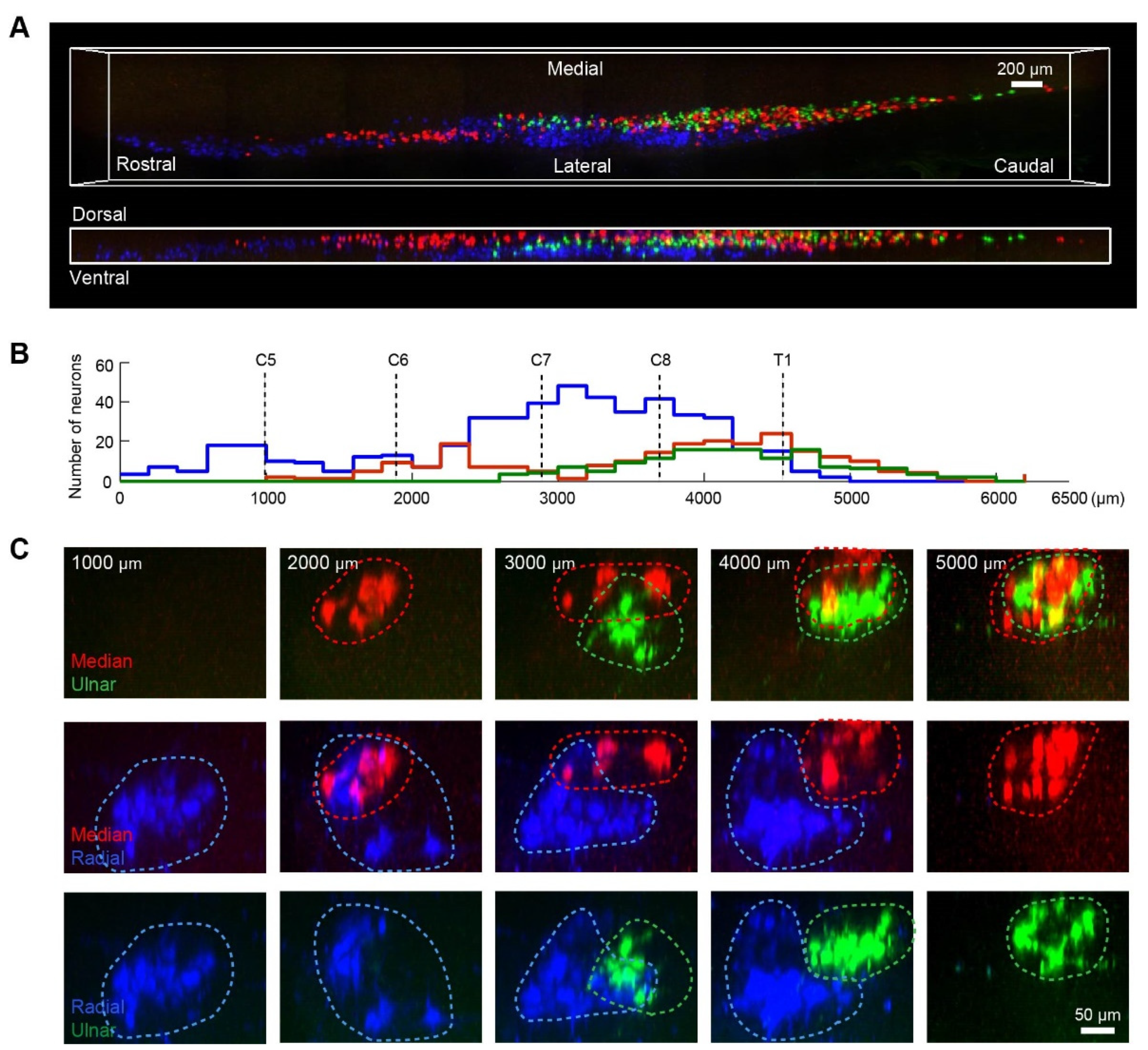 RB system projections to the posterior brain. DAB-CTB staining