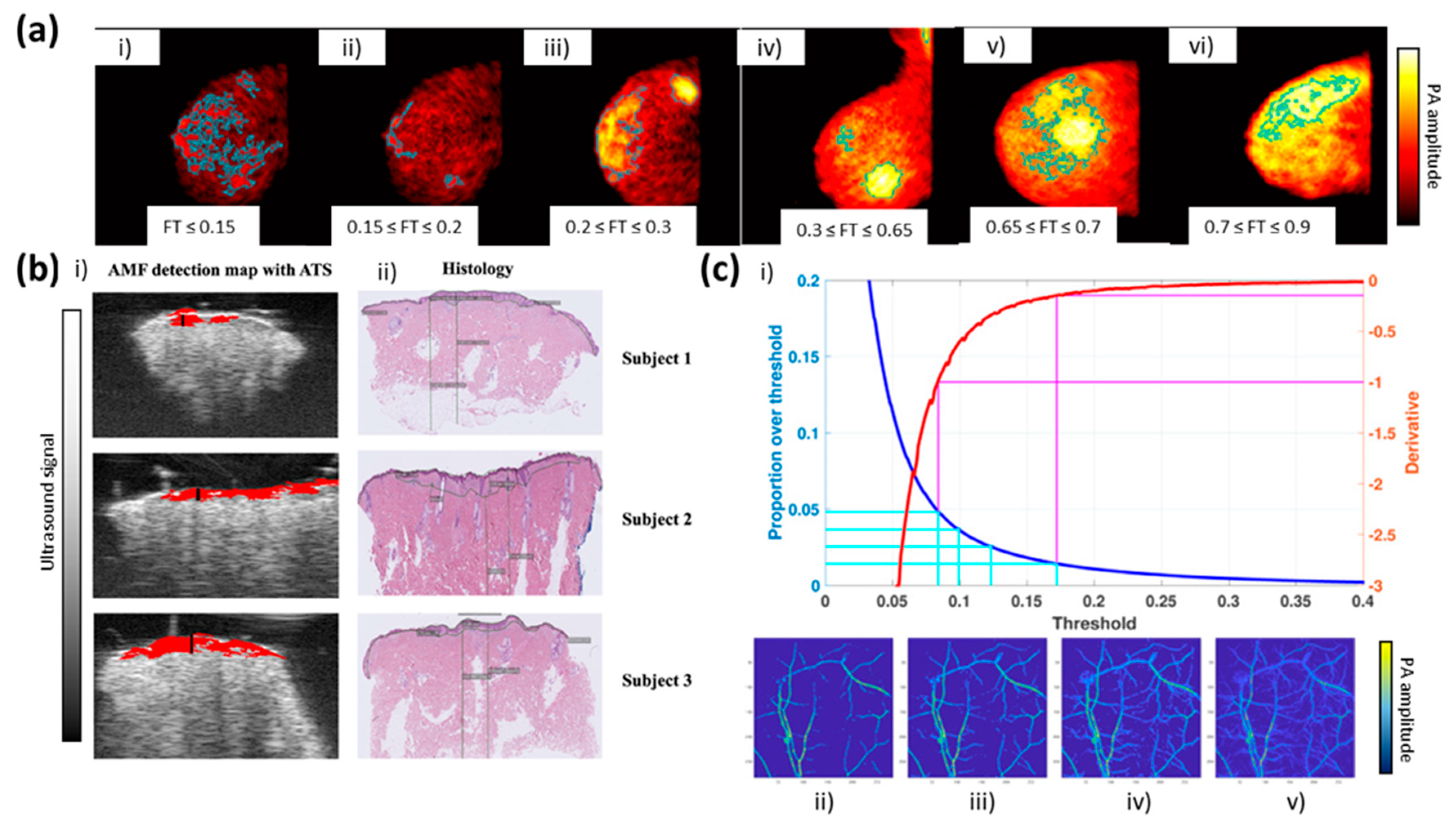 Photonics | Free Full-Text | Segmentation and Quantitative Analysis of  Photoacoustic Imaging: A Review | HTML